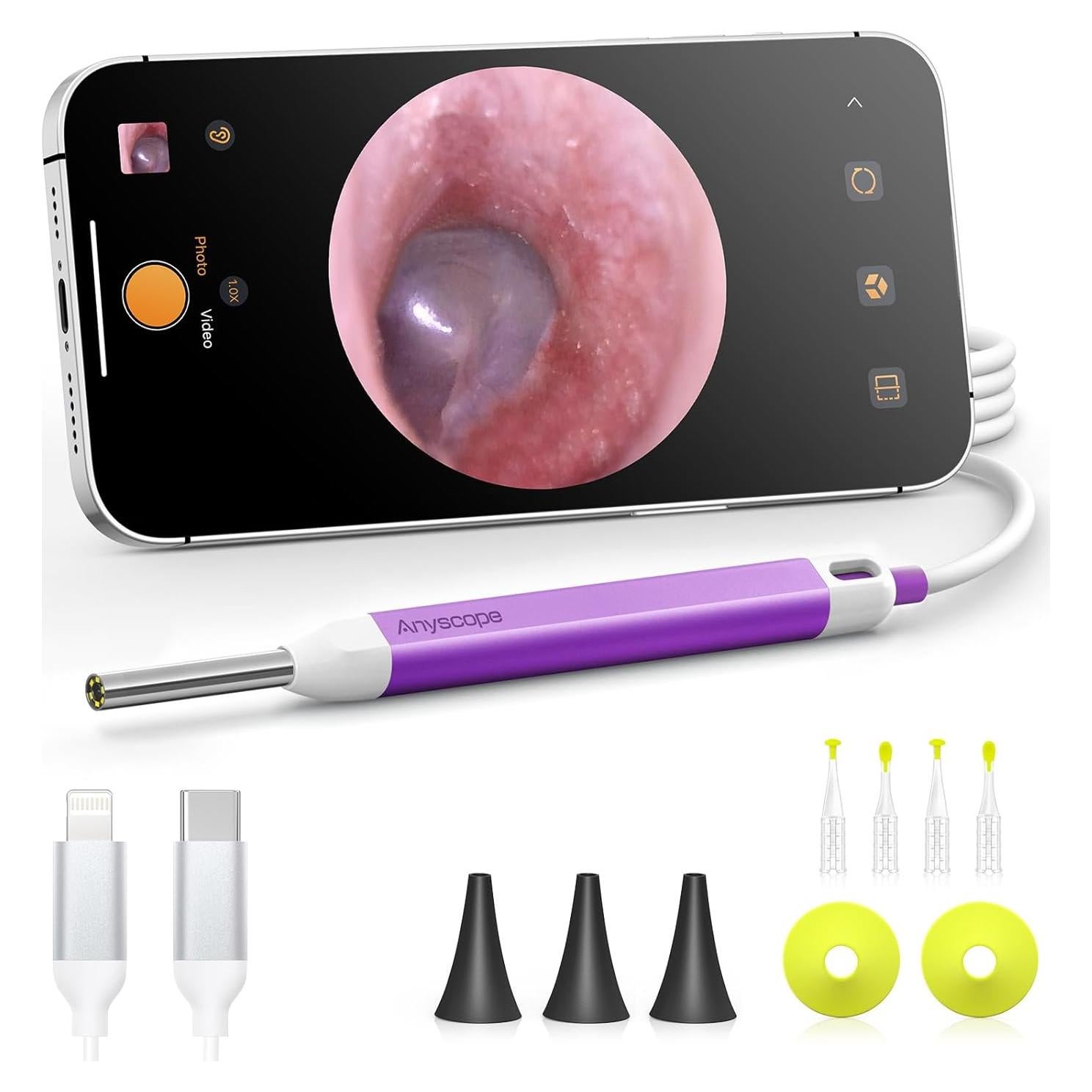 Otoscopio Digital AnyScope ASAKE100i HD con Luz y Giroscopio