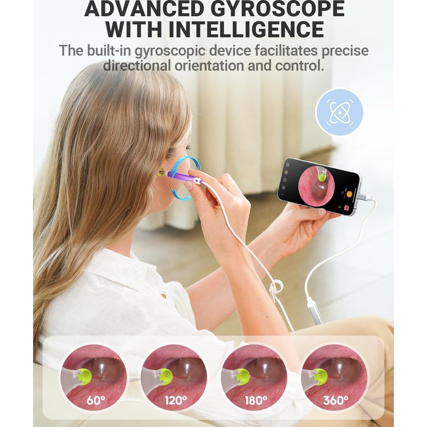 Otoscopio Digital AnyScope ASAKE100i HD con Luz y Giroscopio