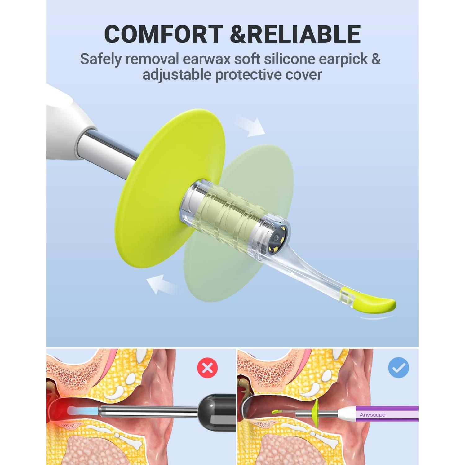 Otoscopio Digital AnyScope ASAKE100i HD con Luz y Giroscopio