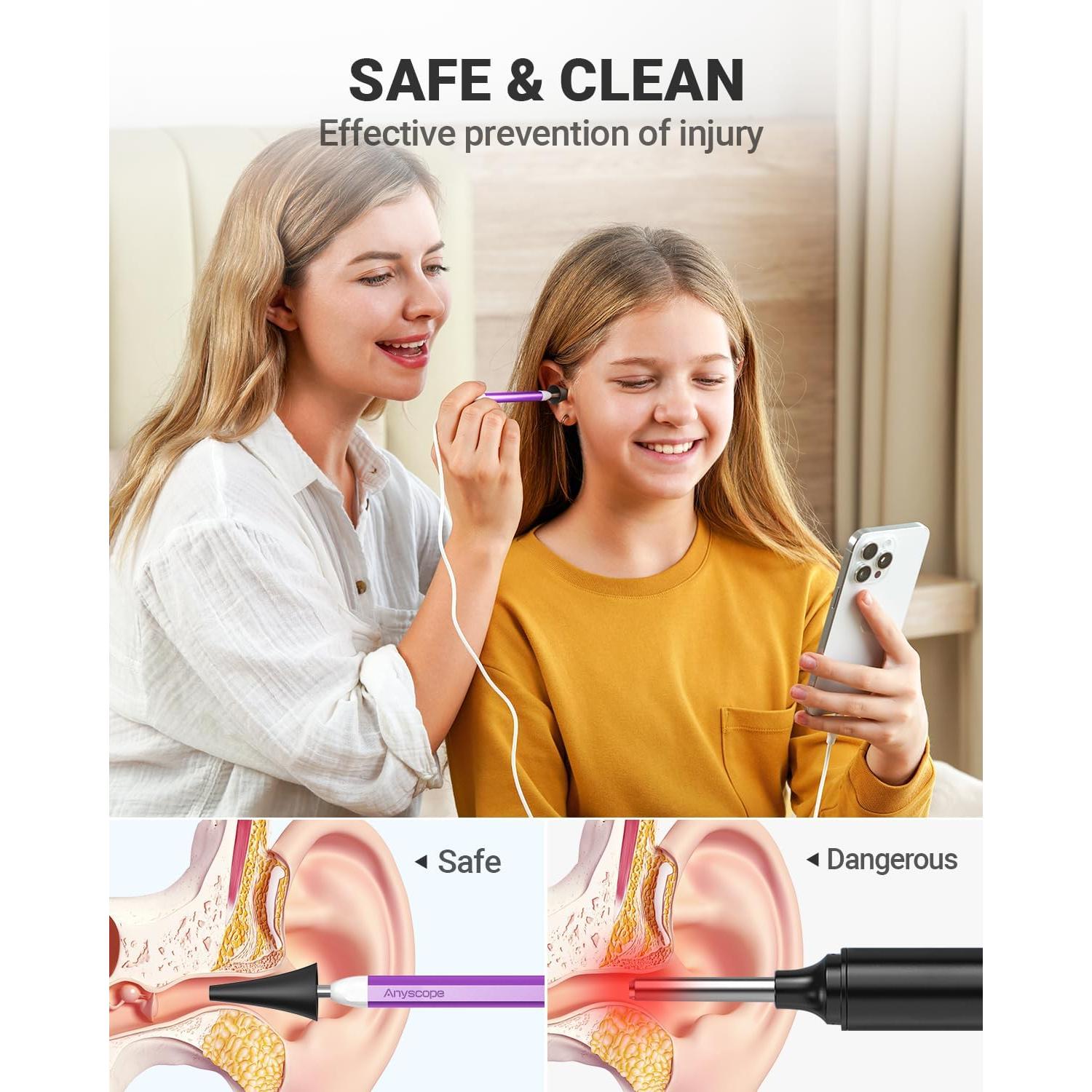 Otoscopio Digital AnyScope ASAKE100i HD con Luz y Giroscopio