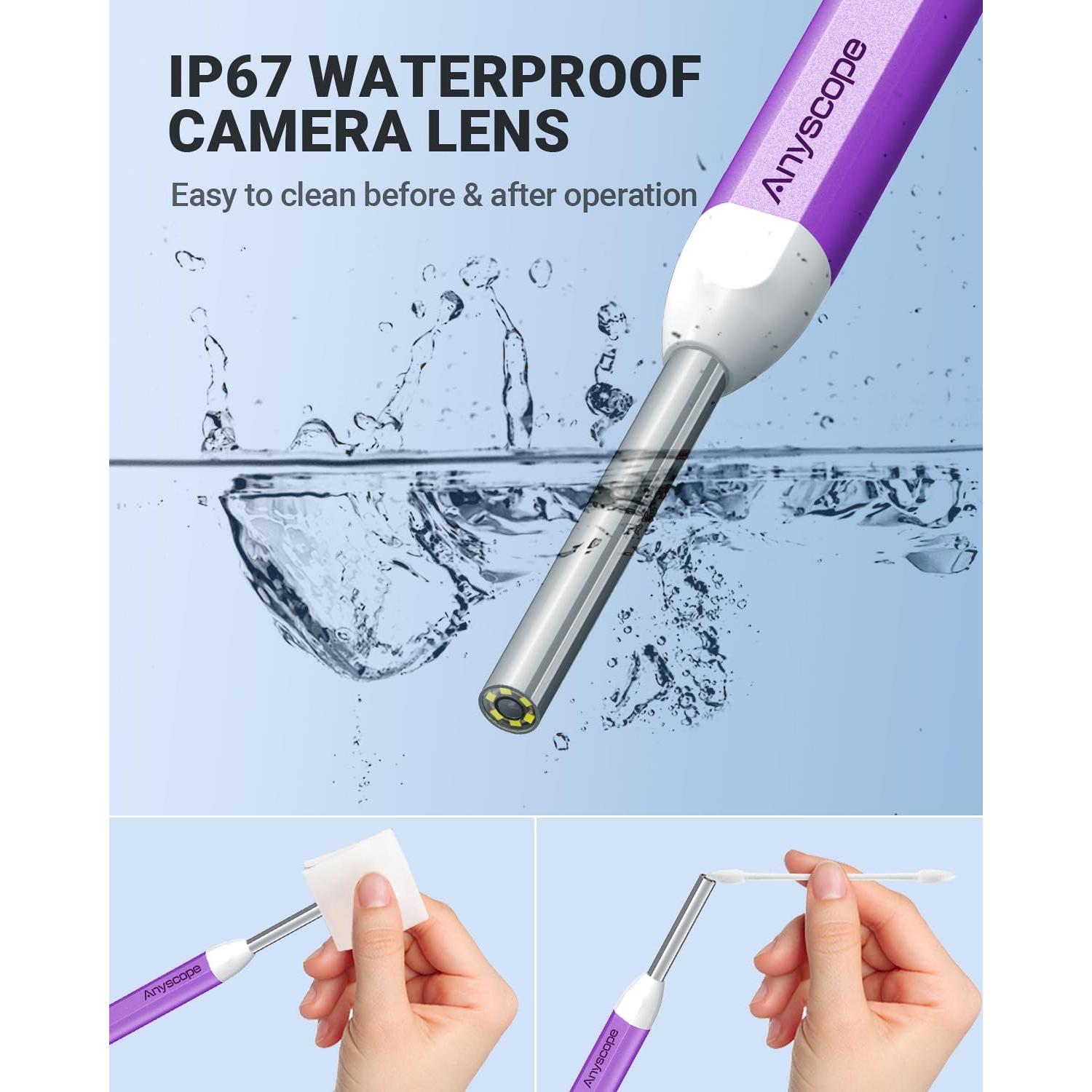 Otoscopio Digital AnyScope ASAKE100i HD con Luz y Giroscopio