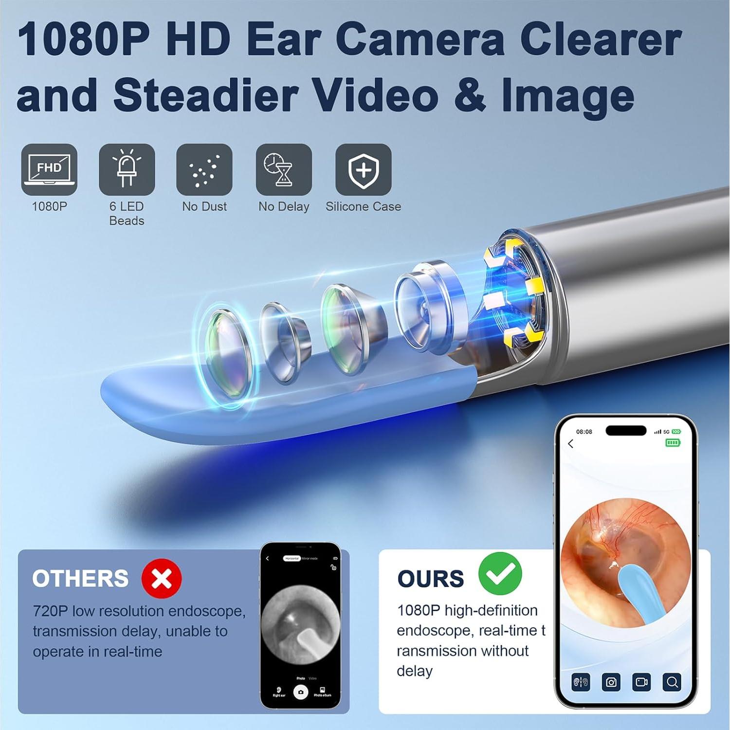 Limpiador de Oídos Coolfor con Cámara 1080P HD y 6 LED