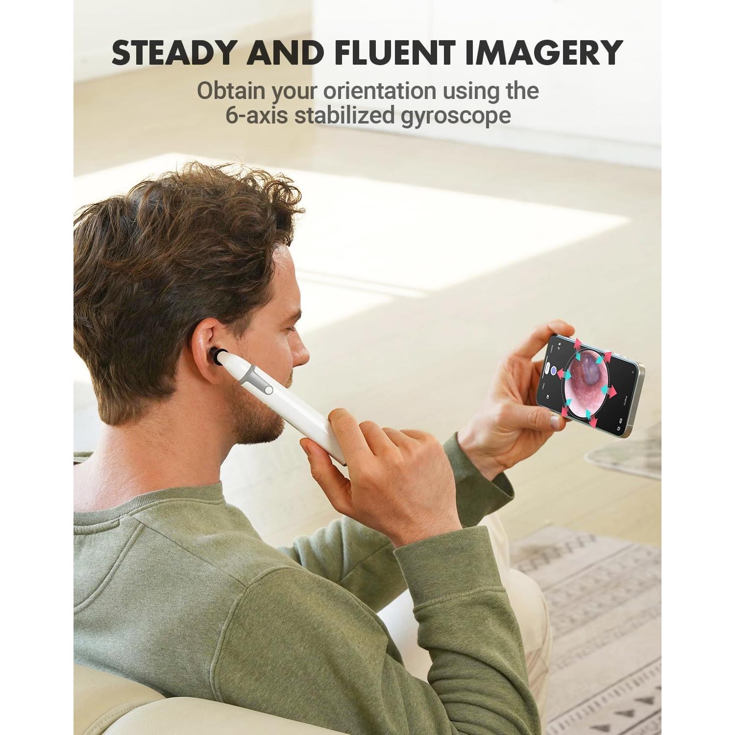 Otoscopio Inalámbrico AnyScope con Cámara y Luz 3.9mm