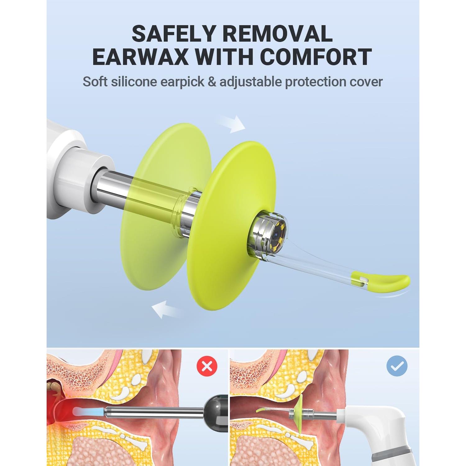 Otoscopio Inalámbrico AnyScope con Cámara y Luz 3.9mm