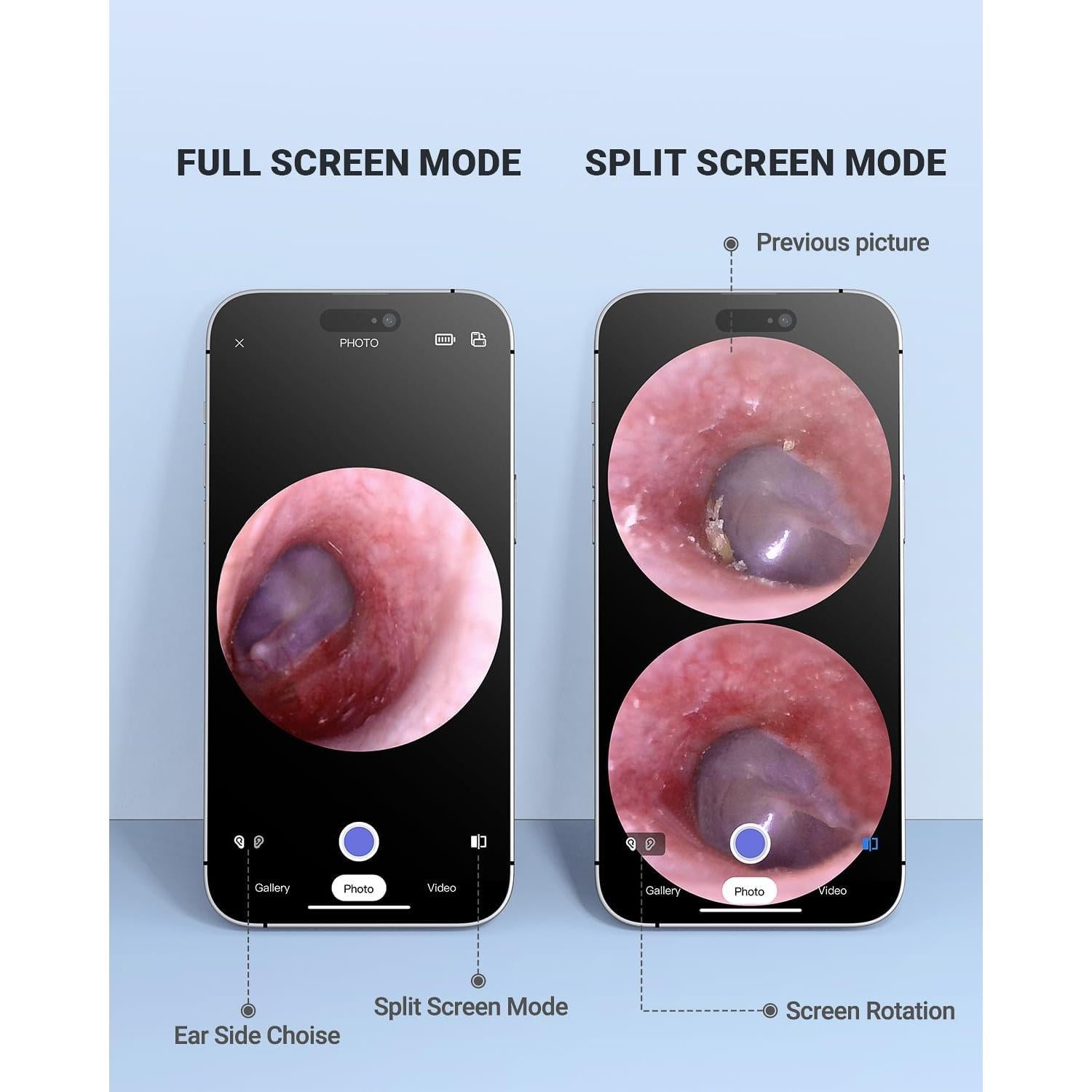Otoscopio Inalámbrico AnyScope con Cámara y Luz 3.9mm