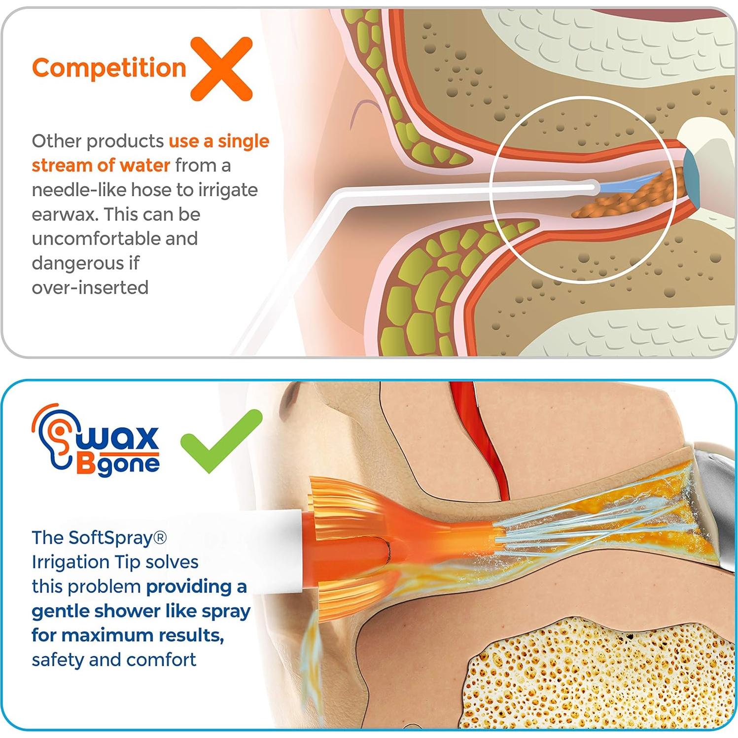 Kit de Limpieza de Oídos WaxBgone con 10 Puntas Reutilizables