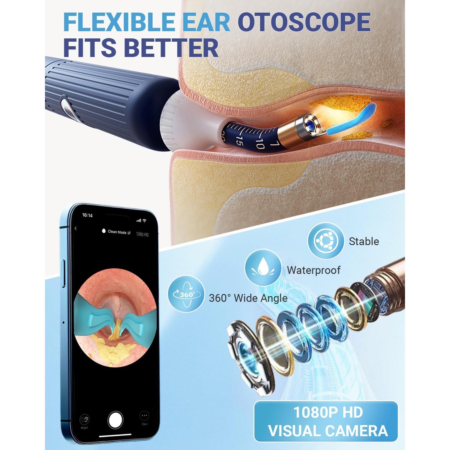 Limpiador de Oídos Inalámbrico DailySee con Cámara HD