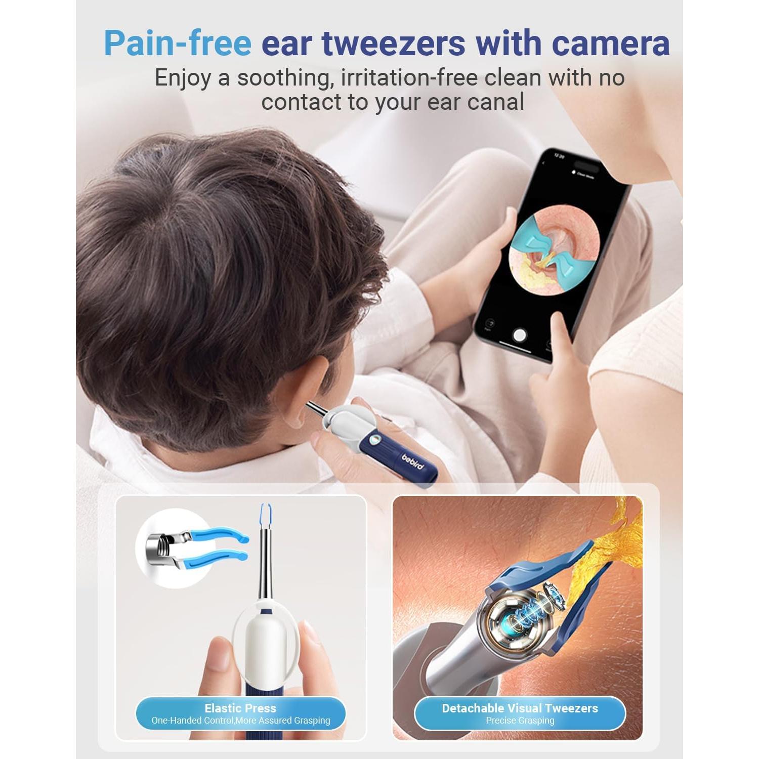 Limpiador de Oídos Inalámbrico DailySee con Cámara HD