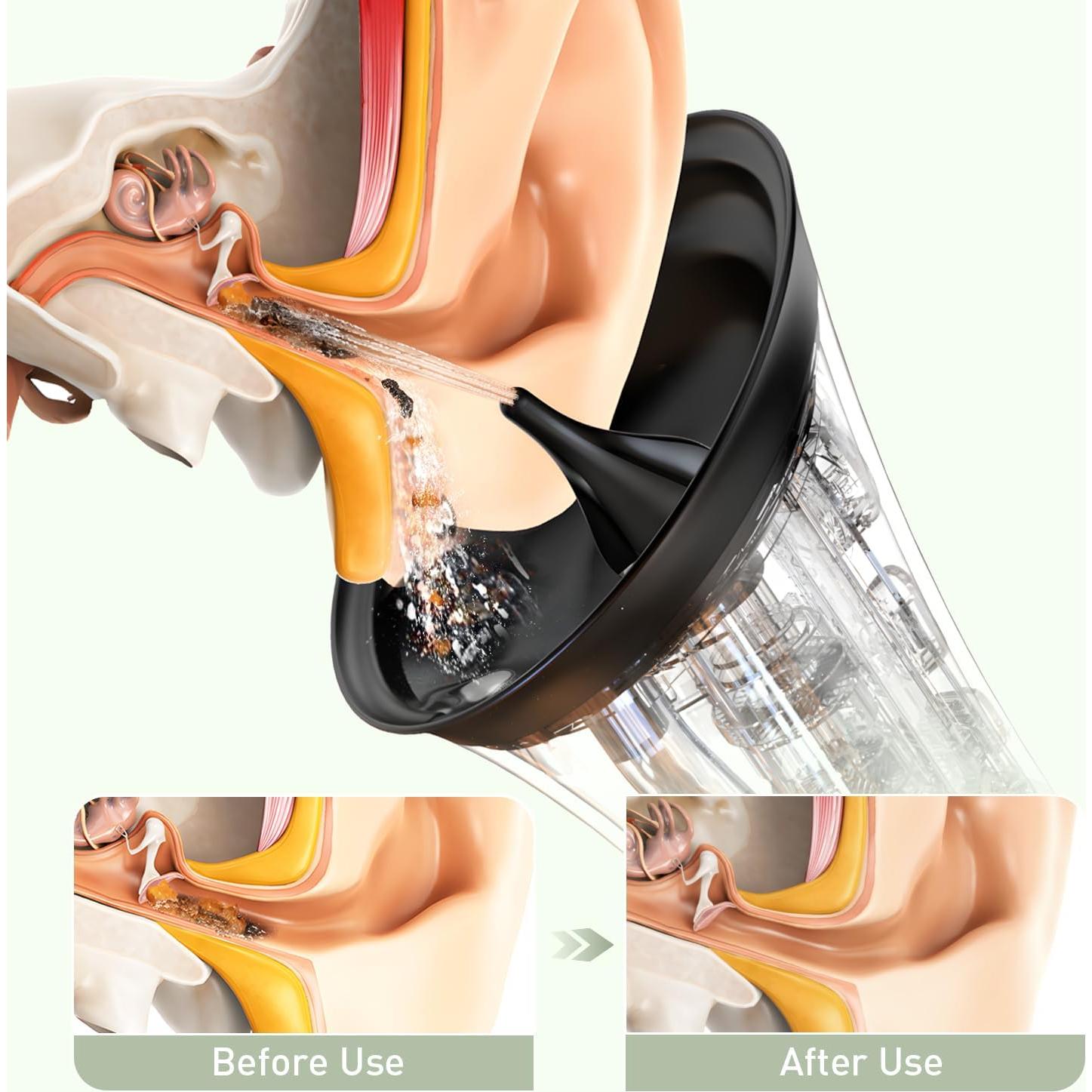 Limpiador de Oído Eléctrico FlaoAito IPX7 con 4 Modos y 6 Puntas