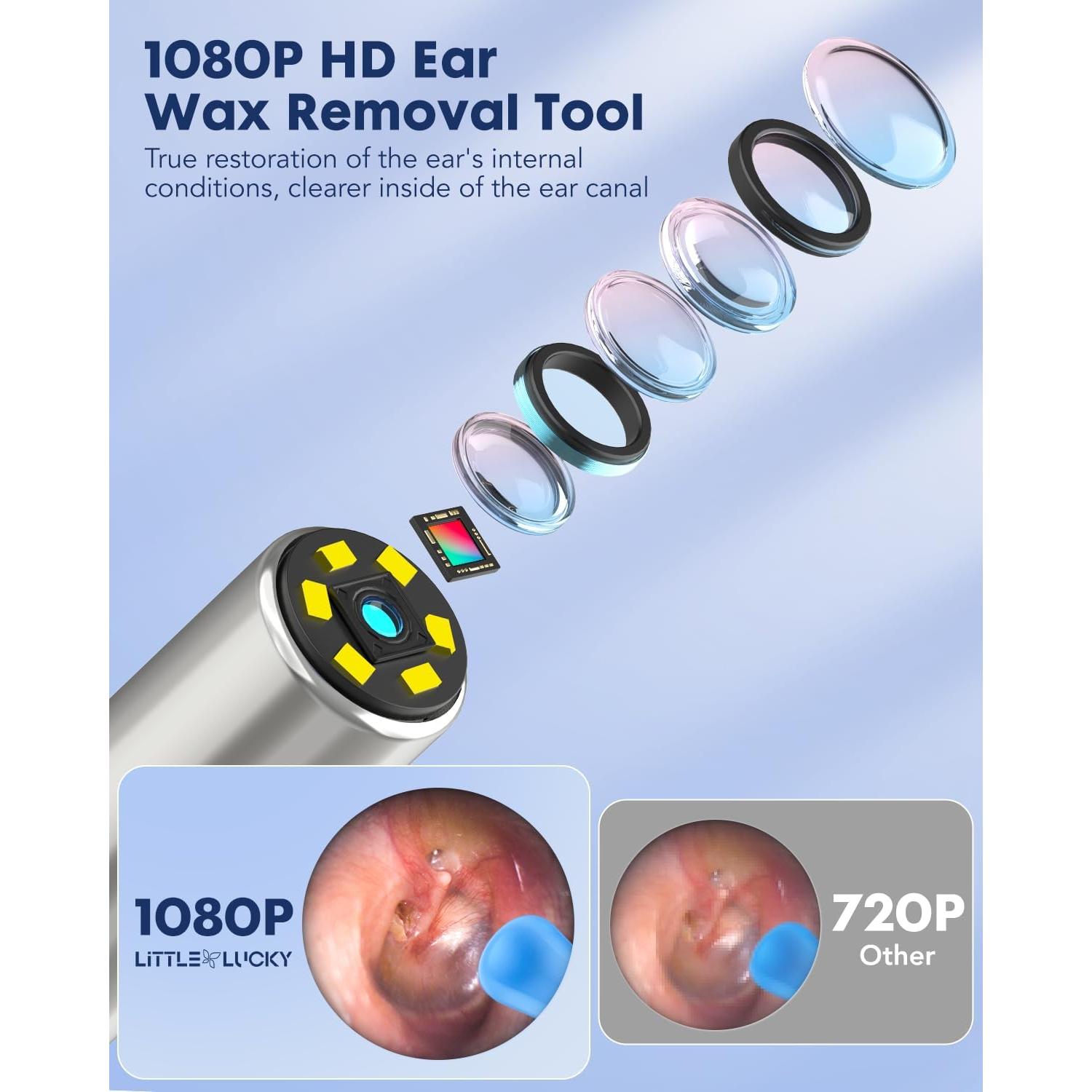 Limpiador de Cera de Oído Littlelucky 1080P con 6 Luces LED