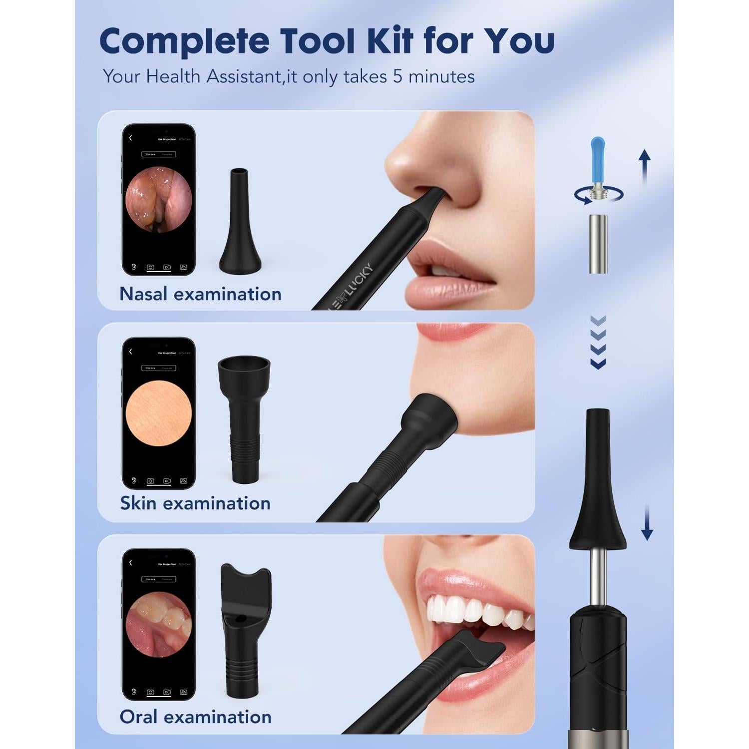 Limpiador de Cera de Oído Littlelucky 1080P con 6 Luces LED