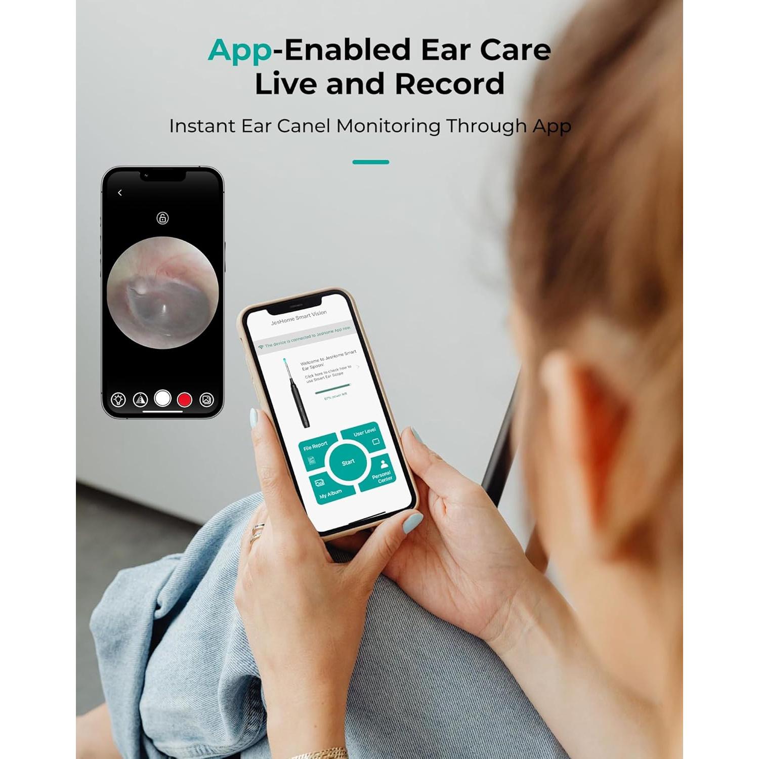 Otoscopio Inalámbrico Jieshi P3-Q2OY-9043 10MP HD con Luz