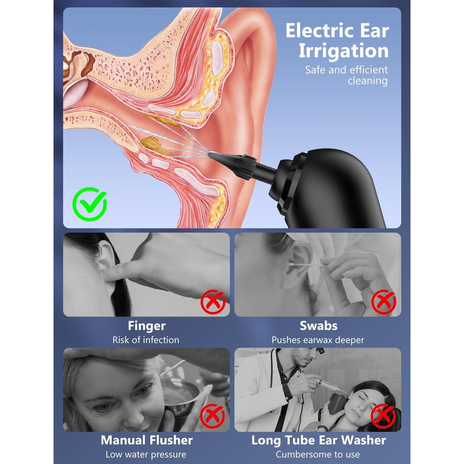 Kit Eliminador de Cerumen VITCOCO con Cámara 1080P y 4 Modos