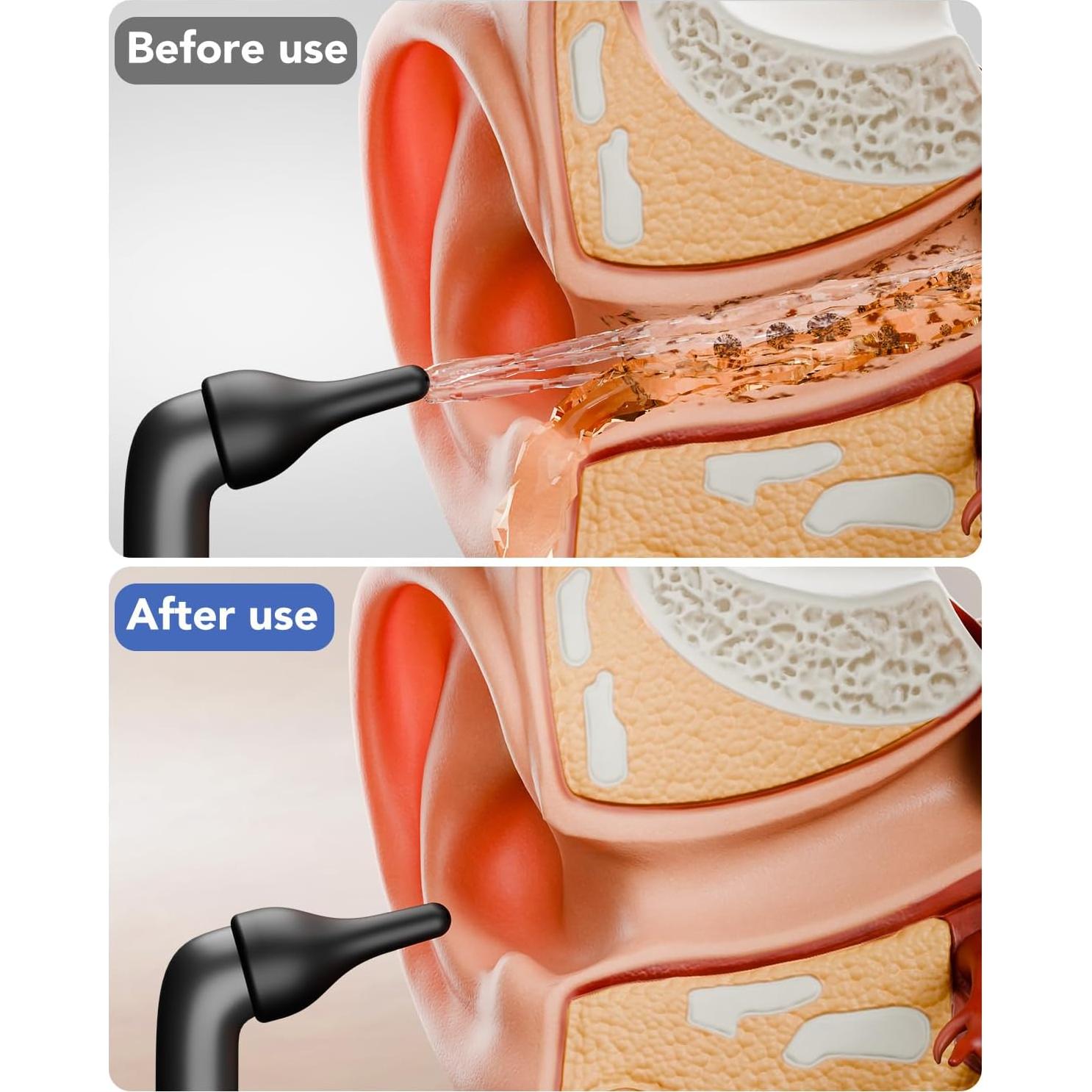Limpiador de Oídos Eléctrico Yakbio con 3 Modos y 12 Puntas