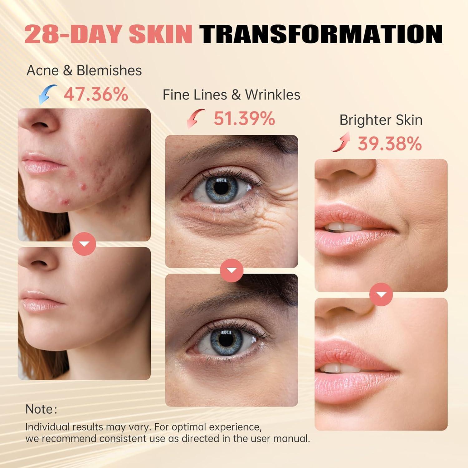 Máscara de Terapia de Luz Roja Quhealro LED 850nm 3 Modos