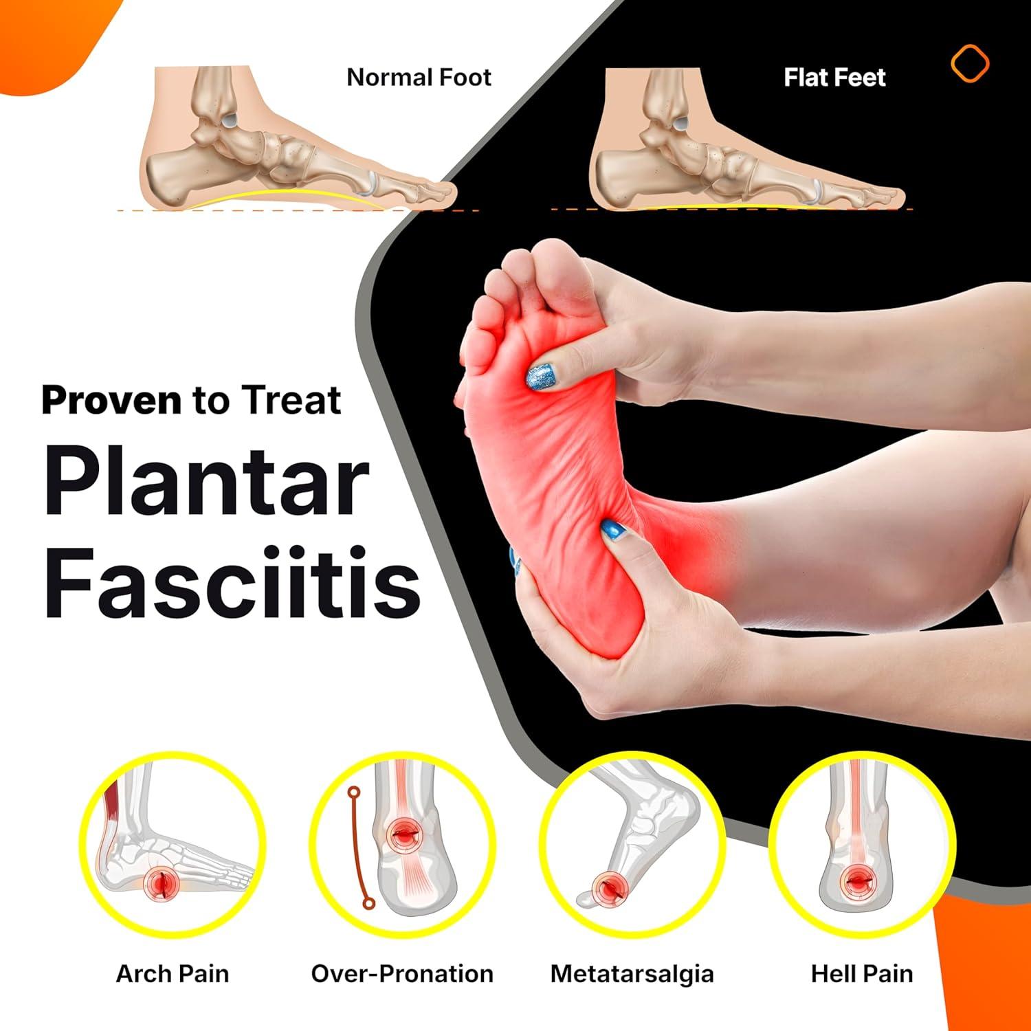 Plantilla de fibra de carbono TEGA DESIGN para alivio de pies planos