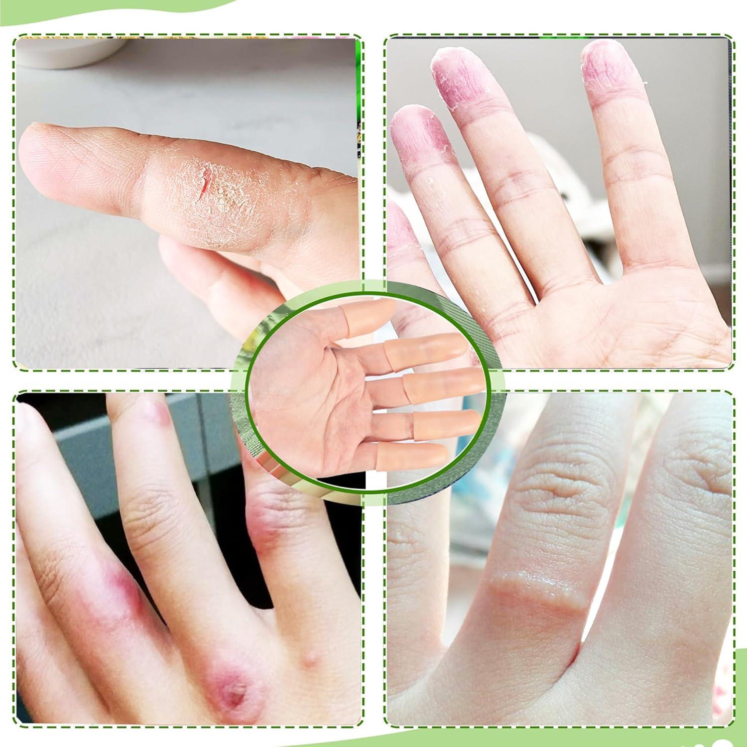 Cubiertas de Dedos de Gel HORNYPOOT - 20 Piezas Protectores