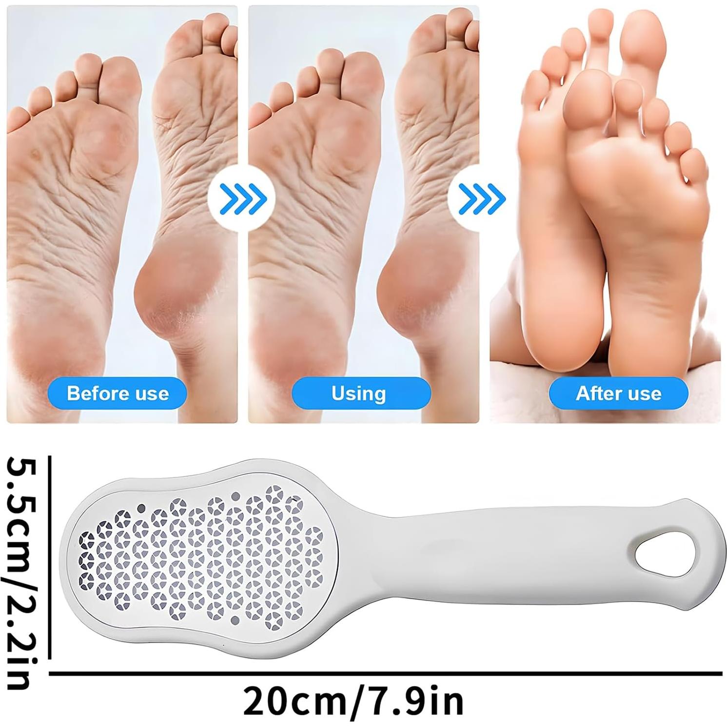 Removedor de Callos Qiifaiikooii de Acero Inoxidable 21cm