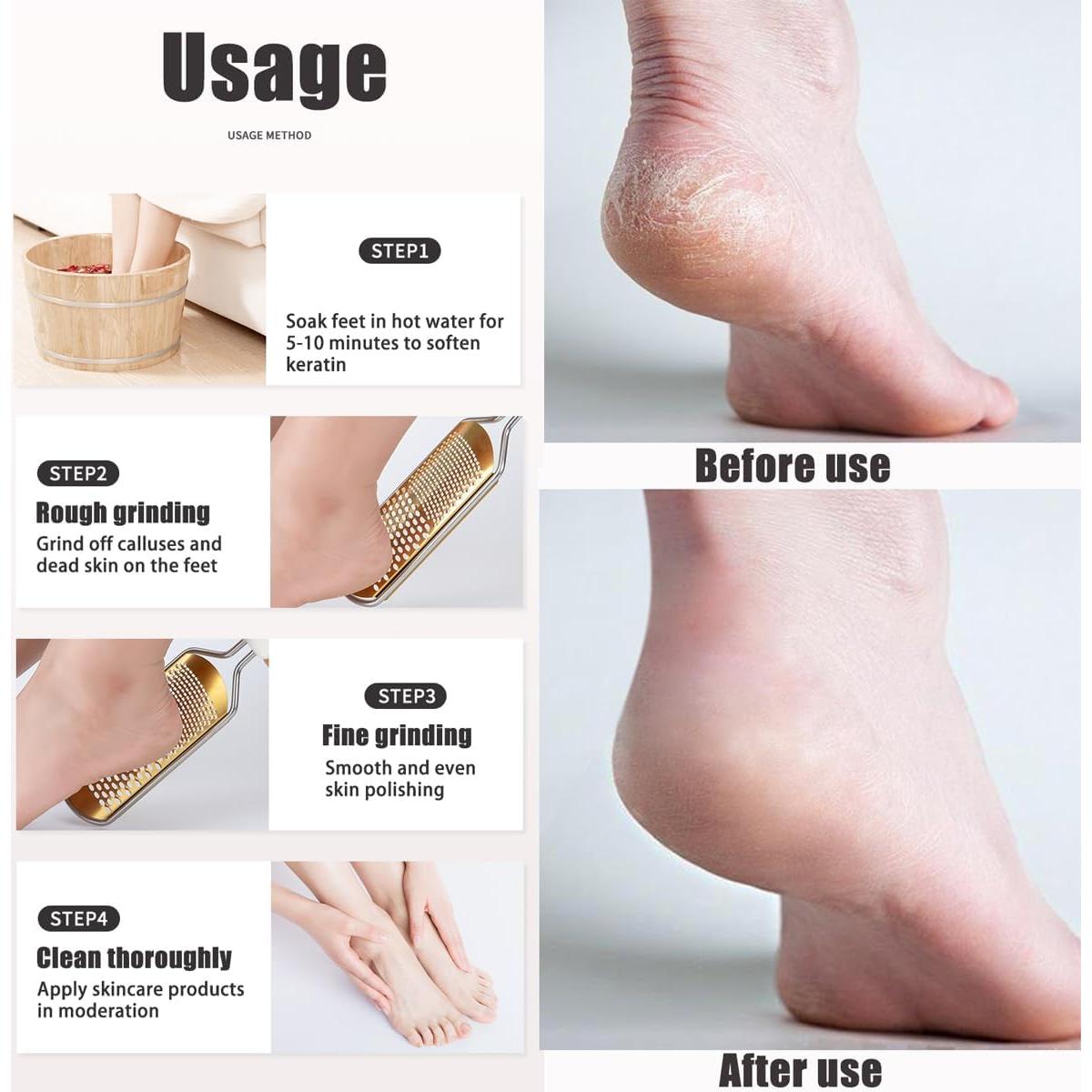 Raspador de pies Roczipeng blanco de acero inoxidable 28.5 cm