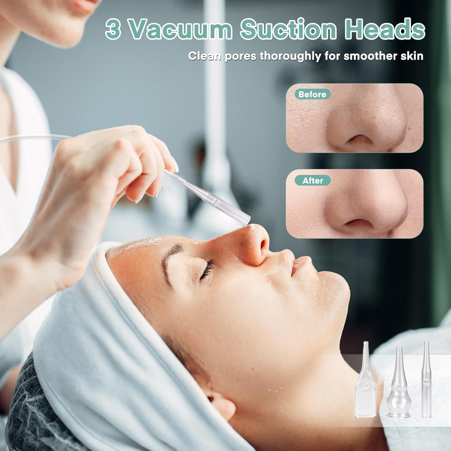 Máquina de Microdermoabrasión Yofuly Profesional 9 Puntas 5.99kg