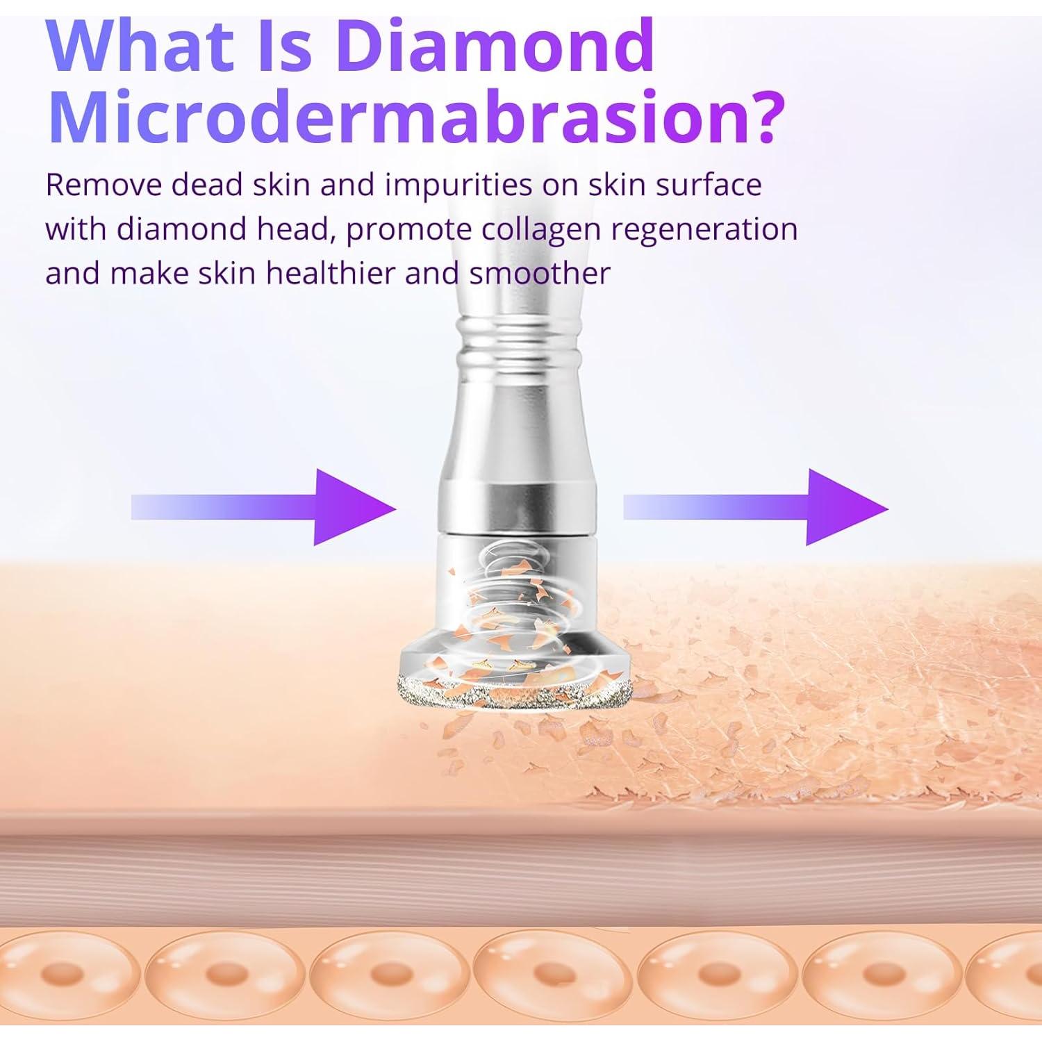 Máquina de Microdermoabrasión UNOISETION con Puntas de Diamante y 50 Filtros