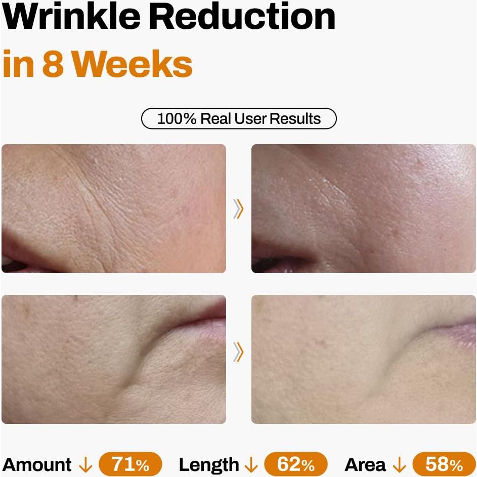 Kit de Elevación Facial Jeu'demeure - Suero Antienvejecimiento