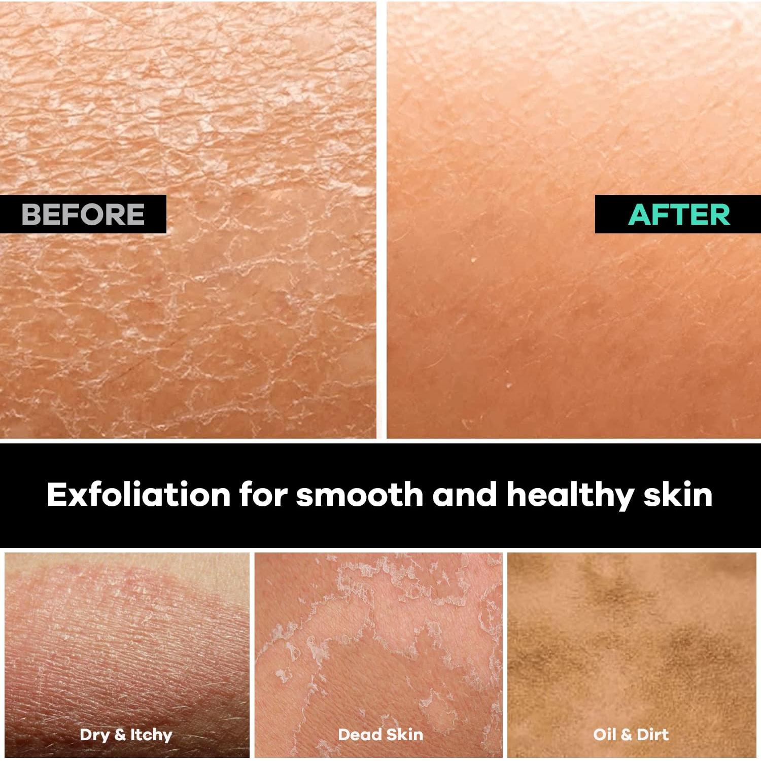 Exfoliador Corporal Dermasuri para Espalda 68.58 cm