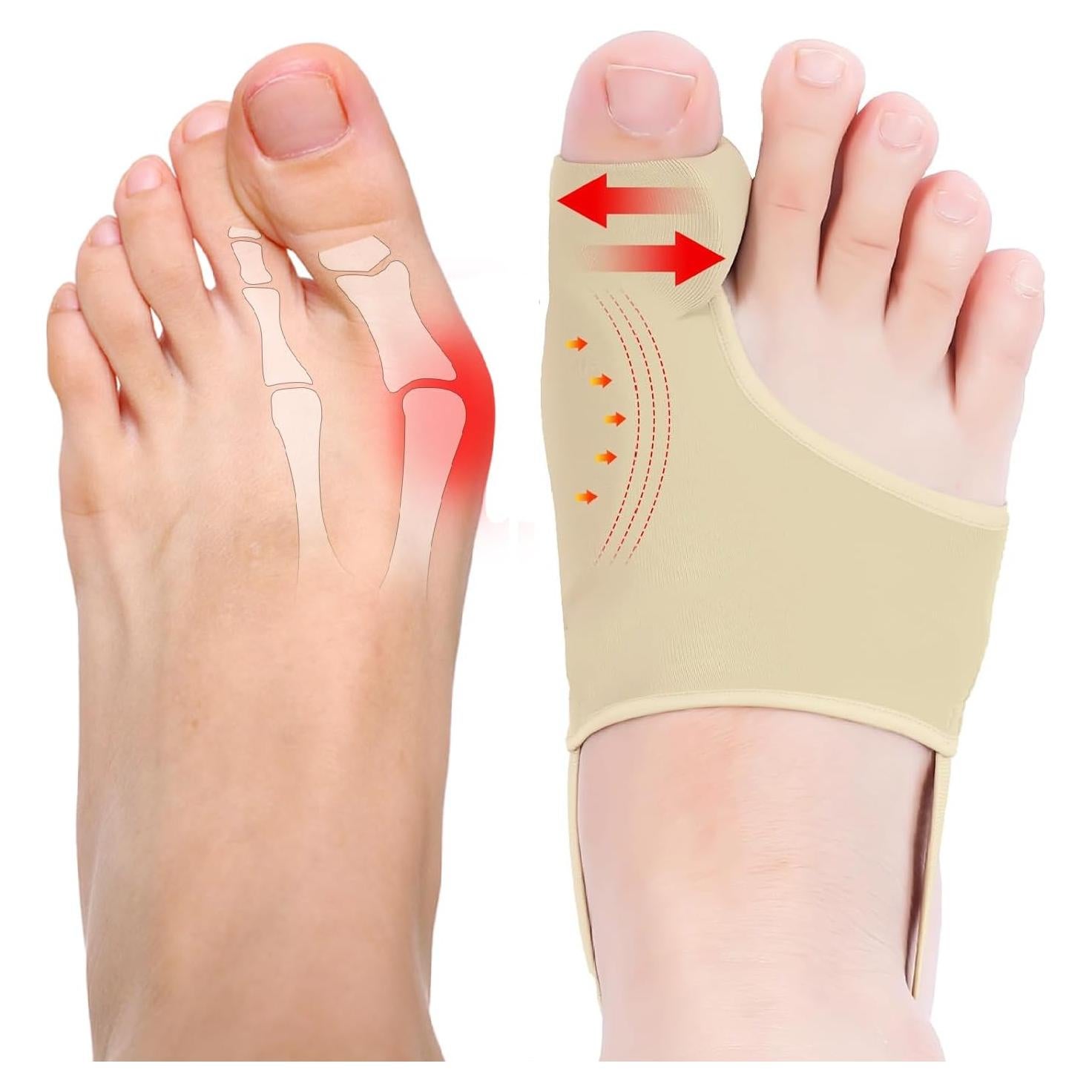 Corrector de Juanetes WELEQUT 2-Pack Beige Alivio Hallux Valgus