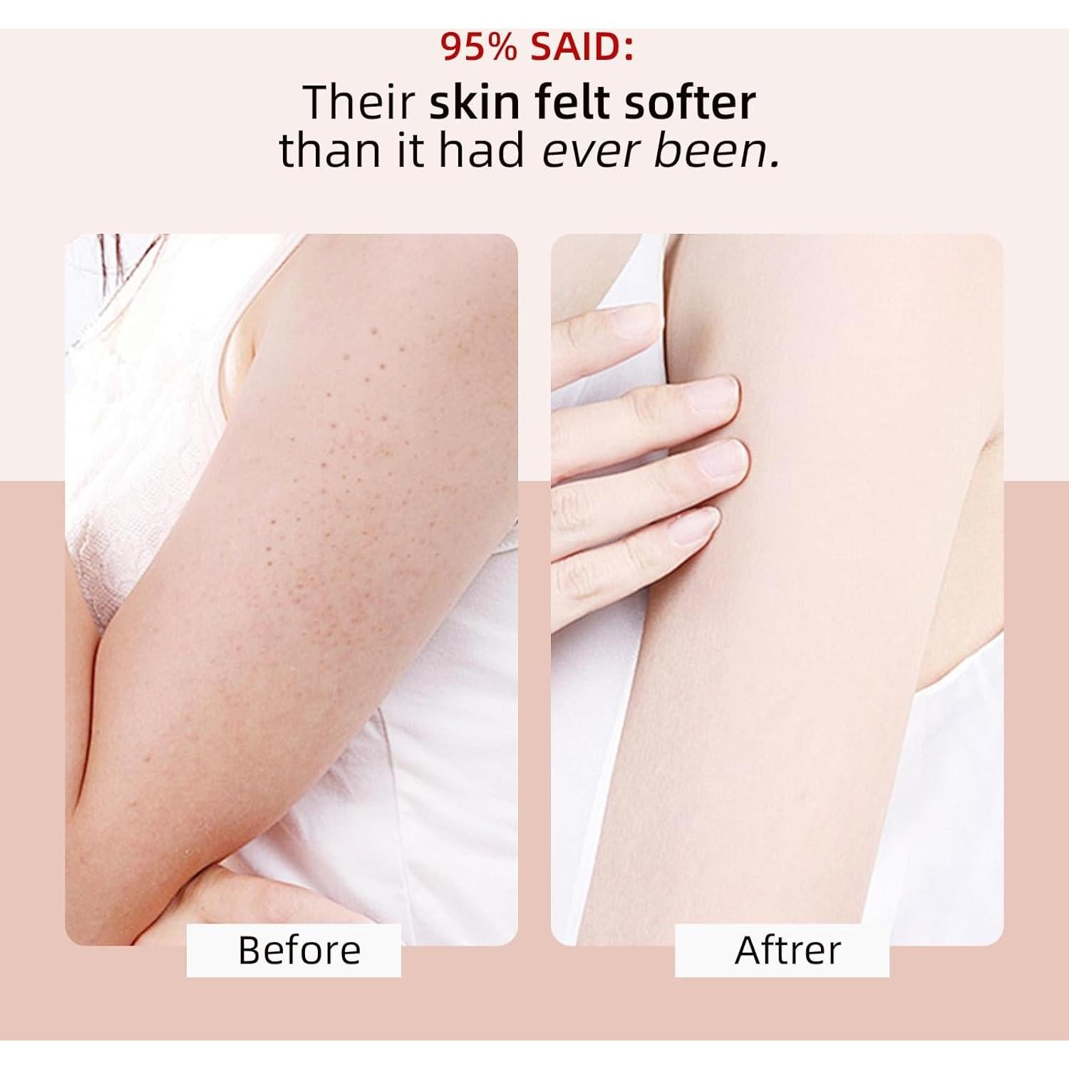 Exfoliante Corporal KP Bump Eraser 120g - AHA Natural para Vellos Encarnados