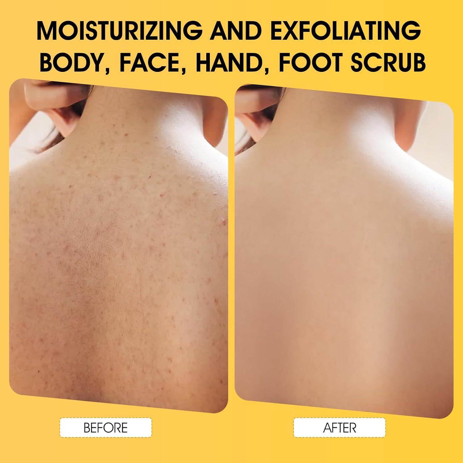 Exfoliante Corporal VOERUY de Cúrcuma con AHA y BHA - 320g