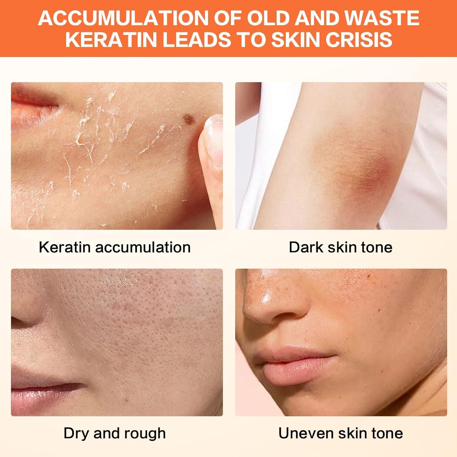 Gel Exfoliante Facial y Corporal Jwtolp 60g Naranja Hidratante