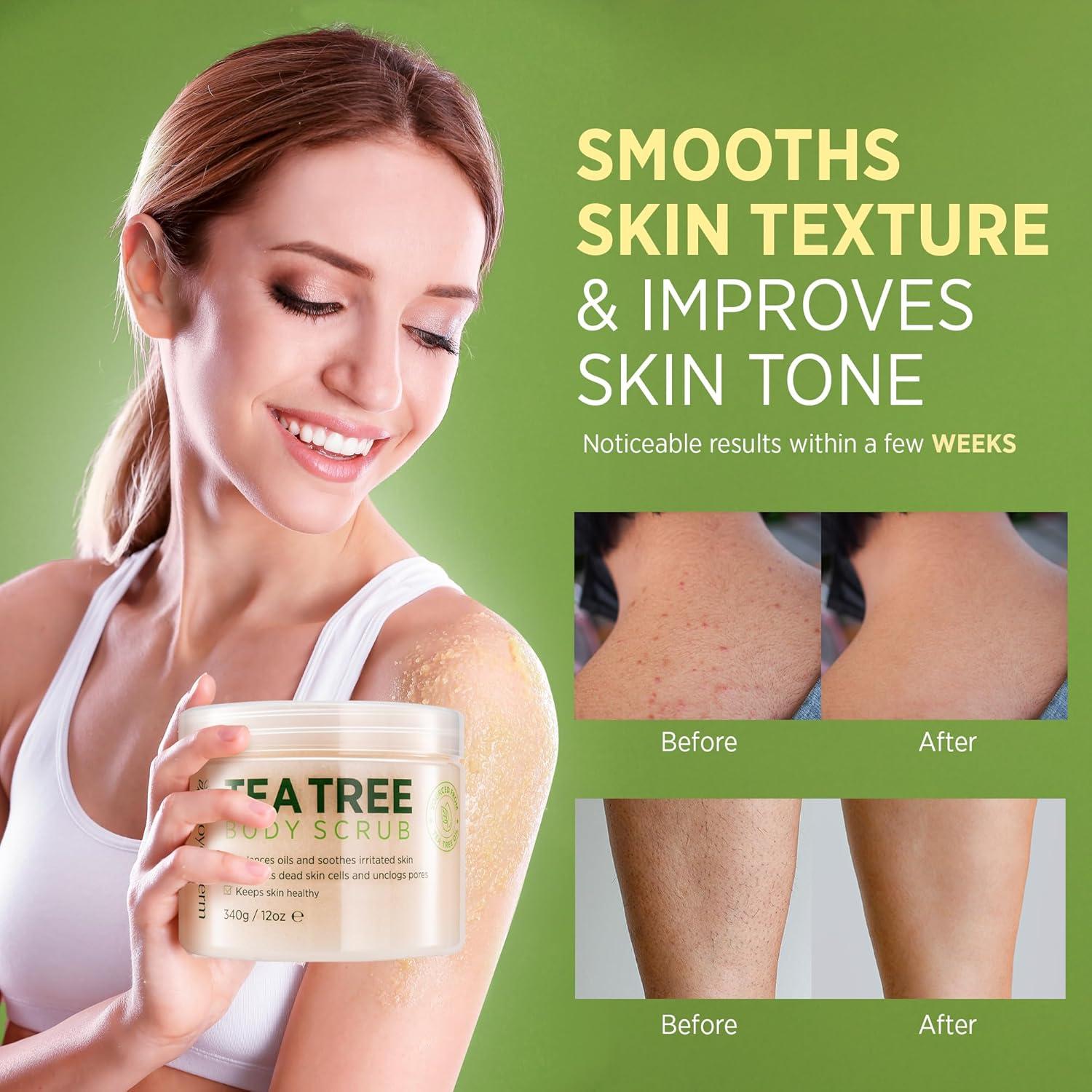 Exfoliante Corporal RoyceDerm con Aceite de Árbol de Té - 340g