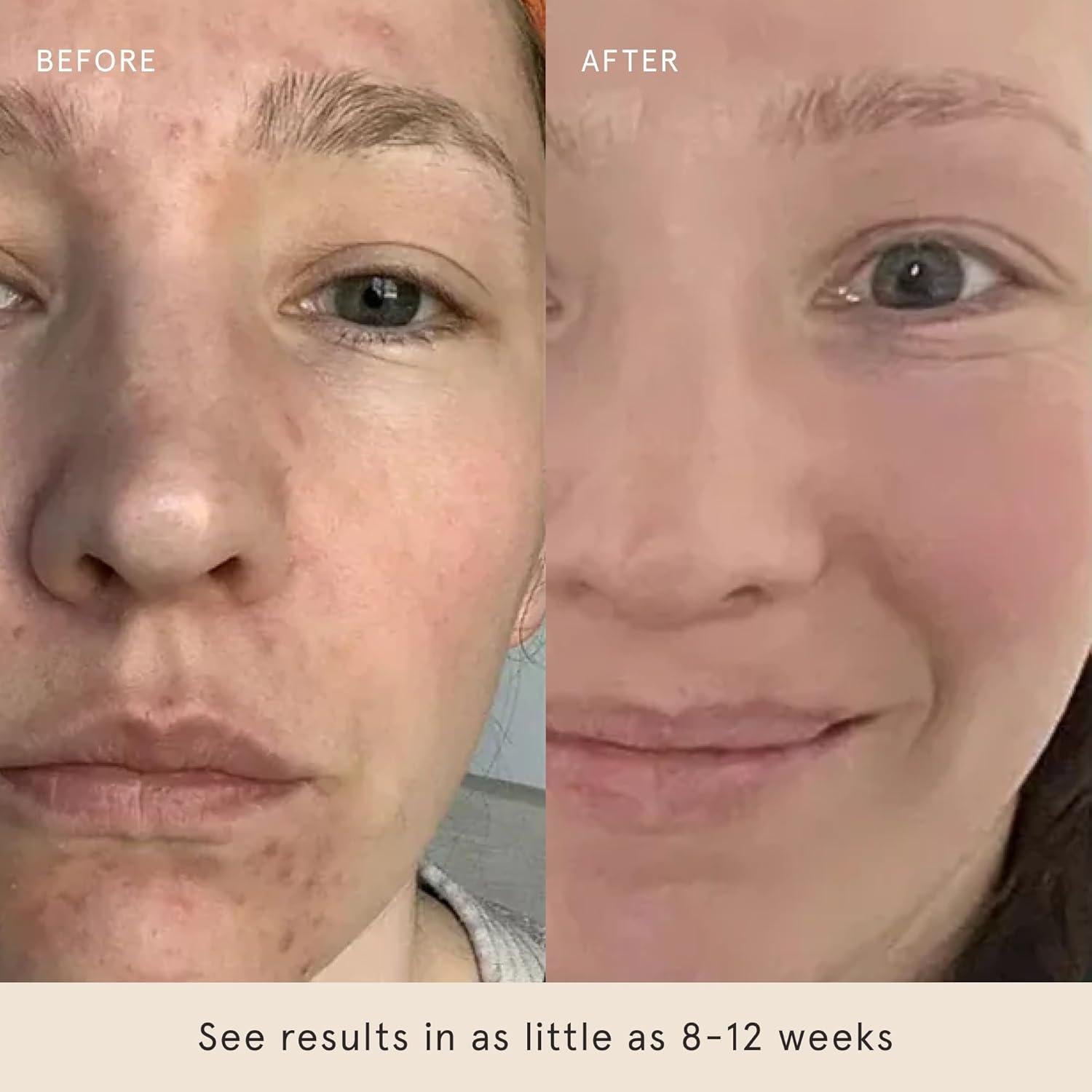 Discos Exfoliantes Barefaced Glow 60 Unidades - 15% Ácido Glicólico