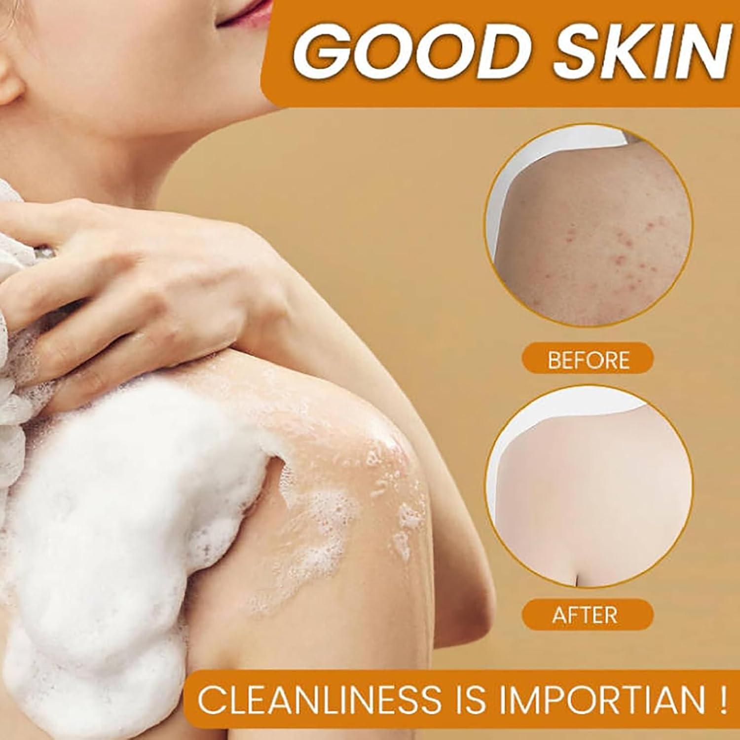 Jabón Natural de Limón y Cúrcuma Kojic Halpilt 180g