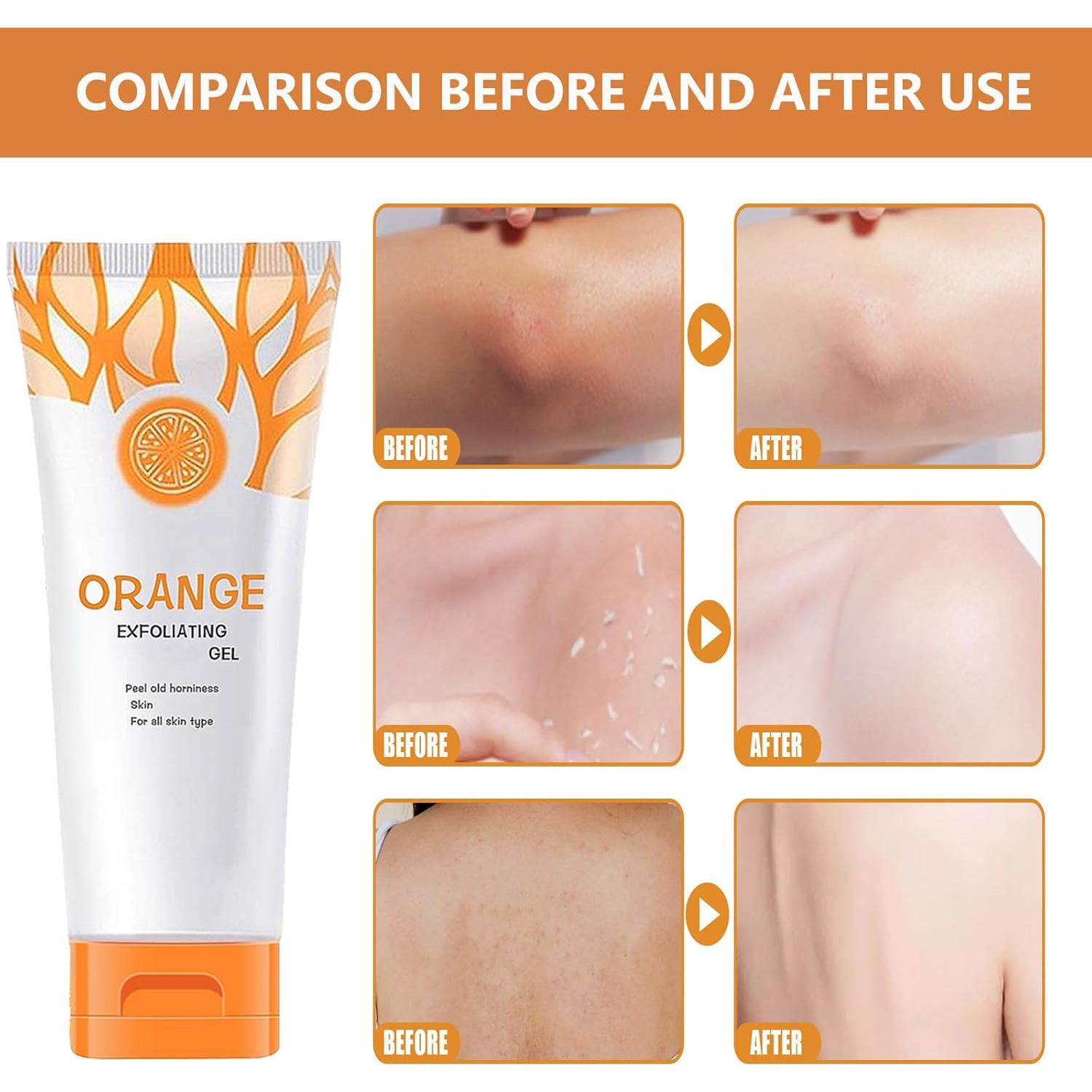 Gel Exfoliante Facial de Naranja Sosofara 3PCS - Limpieza Profunda