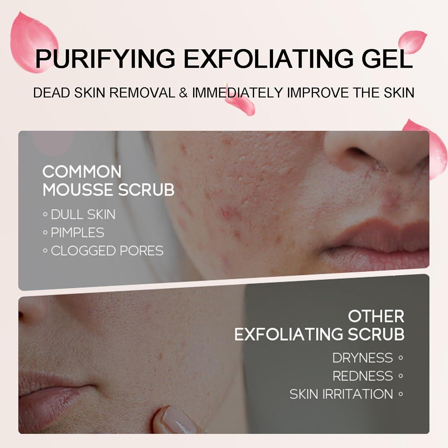 Gel Exfoliante Facial ISHERBIN-QJZ 52 ml Hidratante Suave