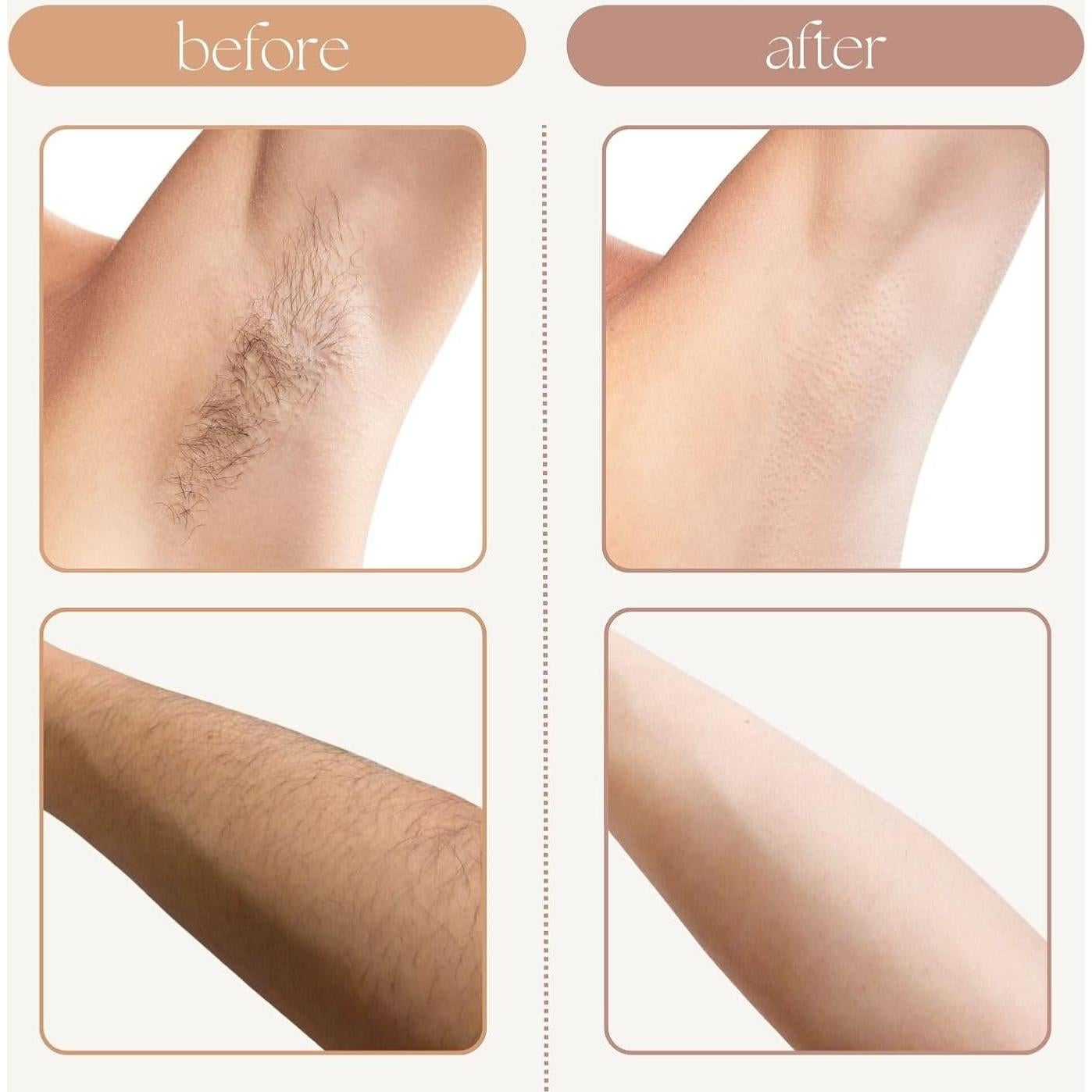 90 Tiras de Cera No Tejidas Waxfans para Cara y Cuerpo