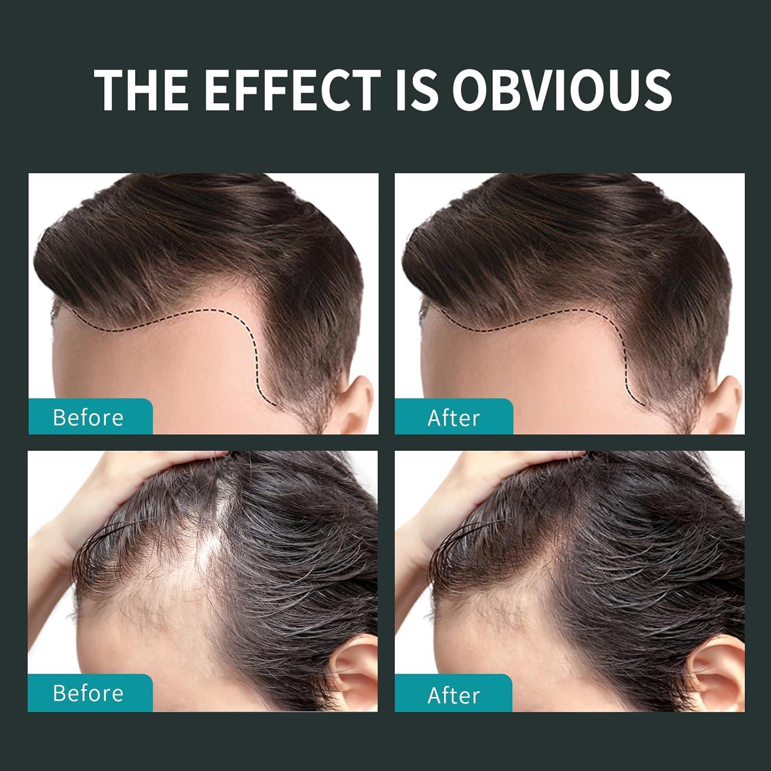 Spray de Fibra Capilar Sevich 120ml Marrón Oscuro - Acondicionador Instantáneo