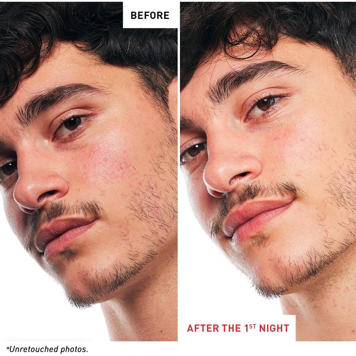 Sérum Nocturno Erborian 9.86 ml - Hidratante Antiarrugas