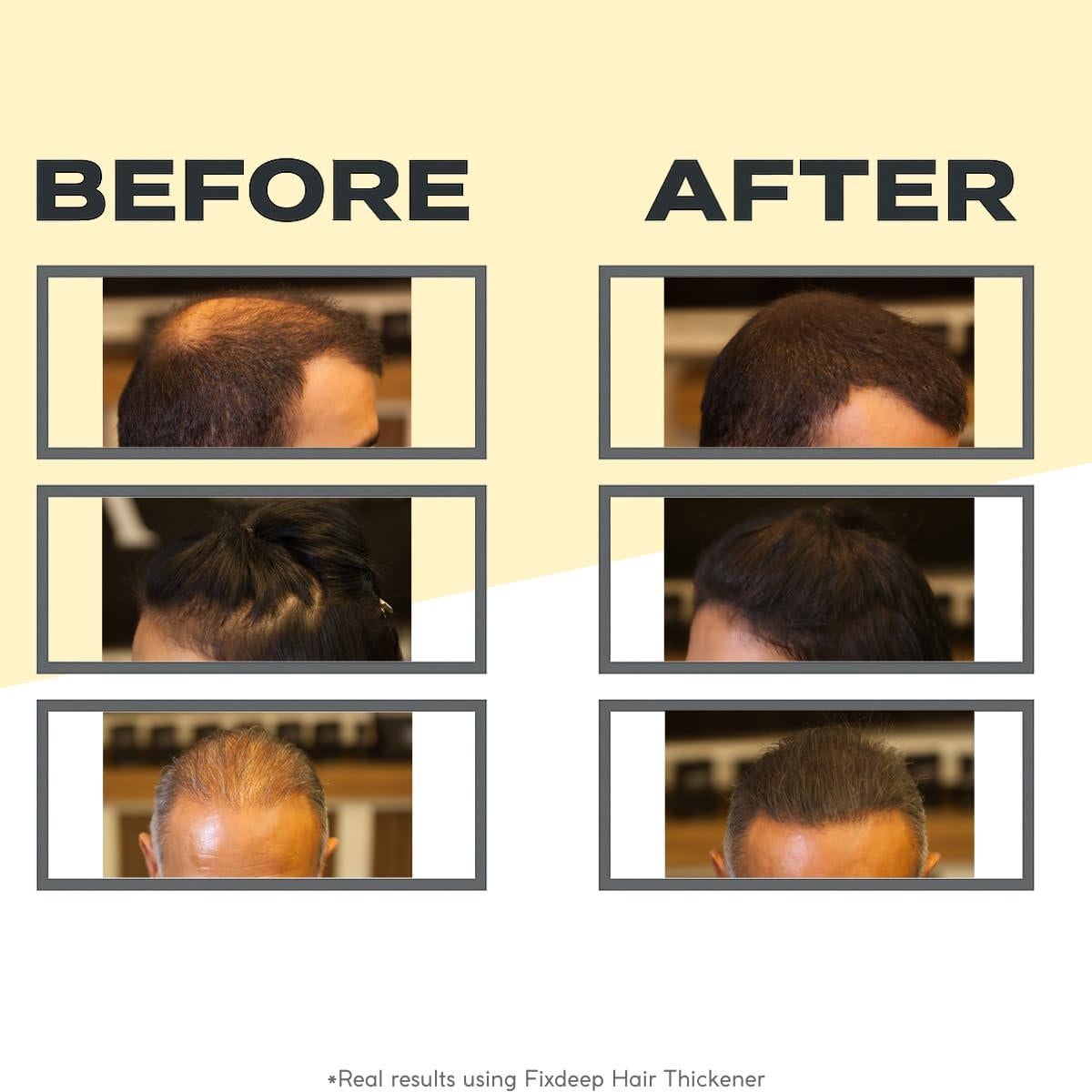 Fibras para Cabello Fino Fix Cosmetic 14g - Negro, Resistente al Agua