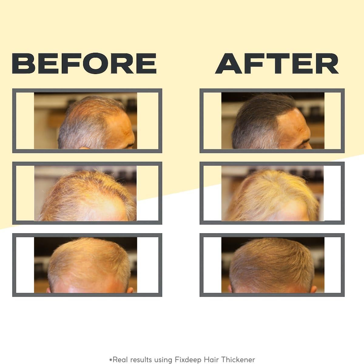 Fibras para Cabello Fino Fix Cosmetic 14g - Negro, Resistente al Agua