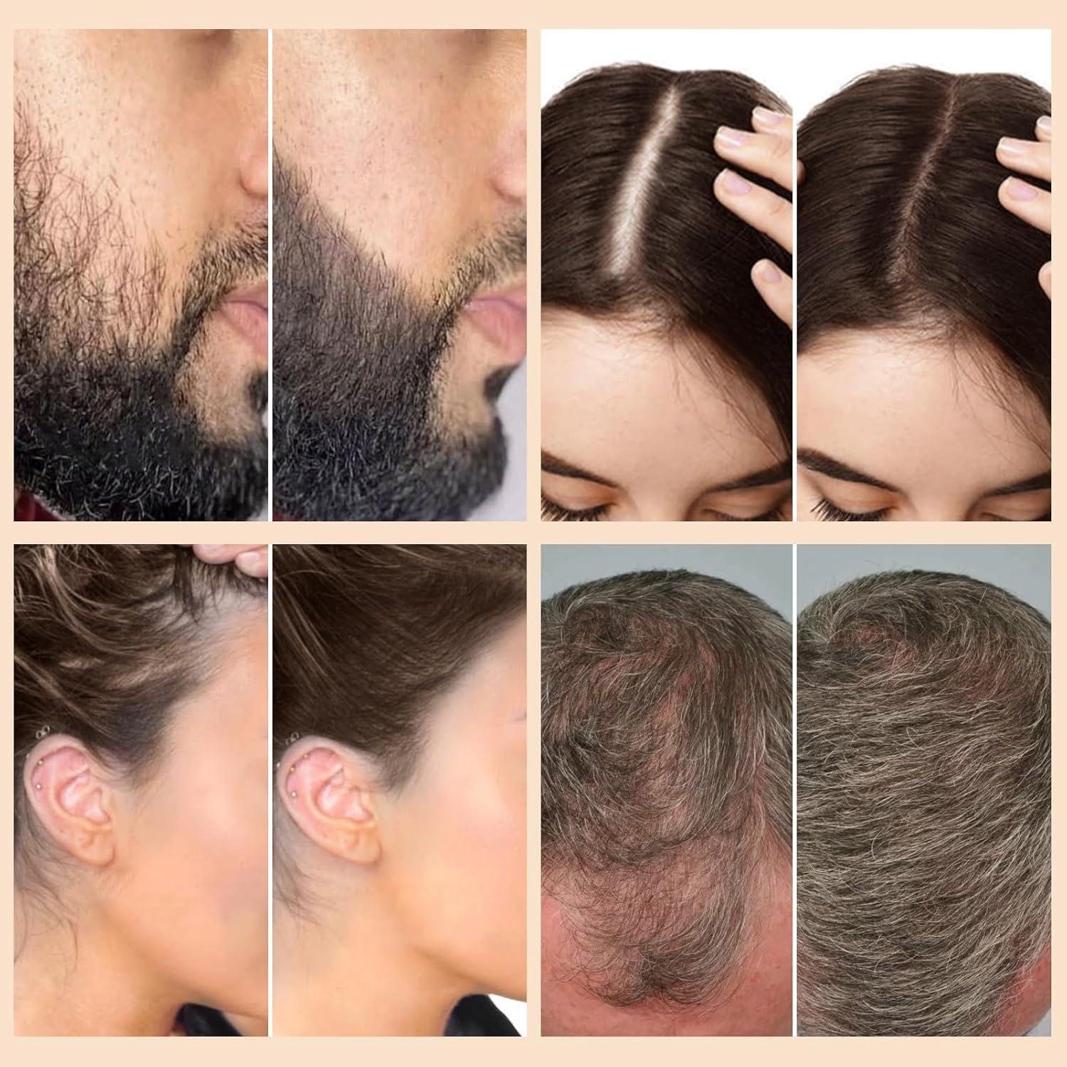 Juego de Aplicador de Fibra para Engrosar Cabello WOZUTUNT - Spray Voluminizador para Hombres