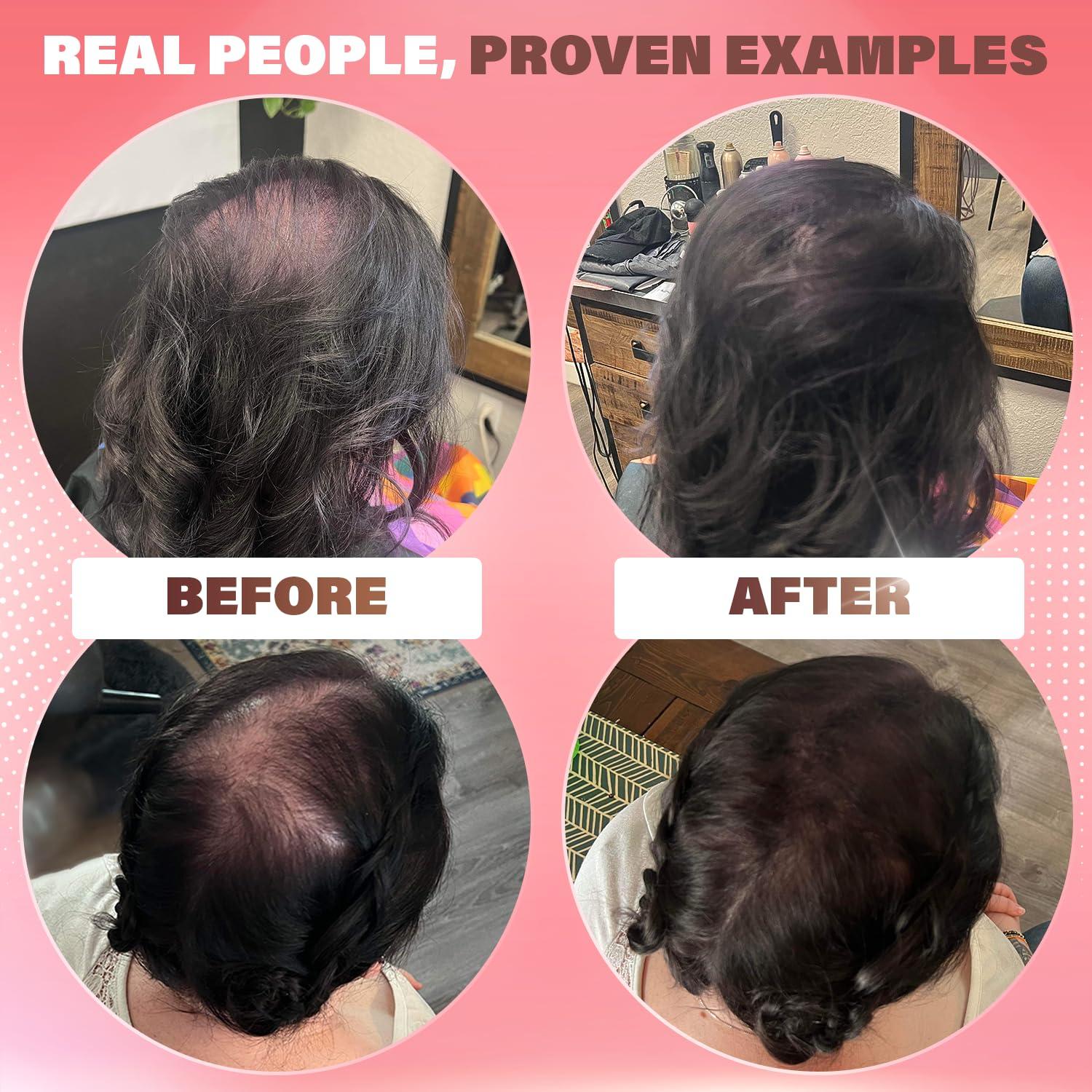 Fibras para Cabello Fino Rejuvenate - Marrón Medio 27.5g