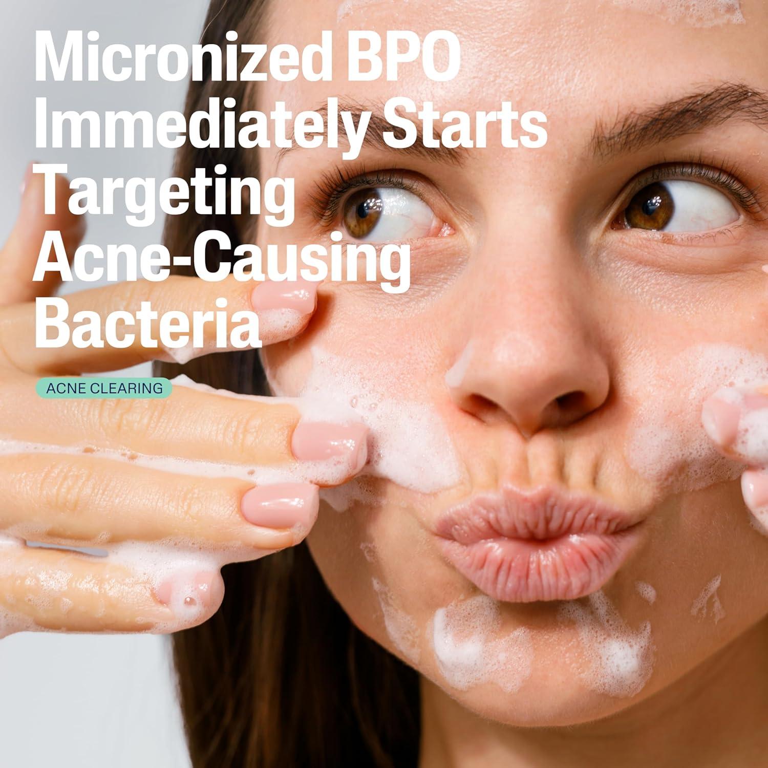 Limpiador Suave Cetaphil para Acné 2.6% BPO 119g Piel Sensible