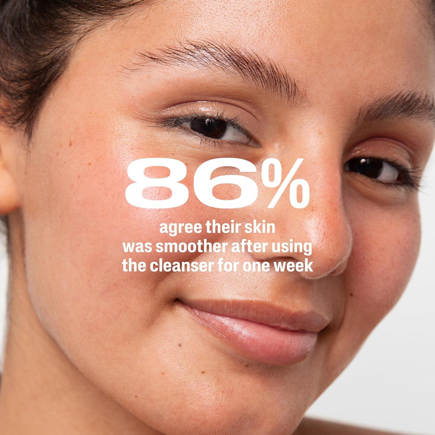 Limpiador Suave Cetaphil para Acné 2.6% BPO 119g Piel Sensible