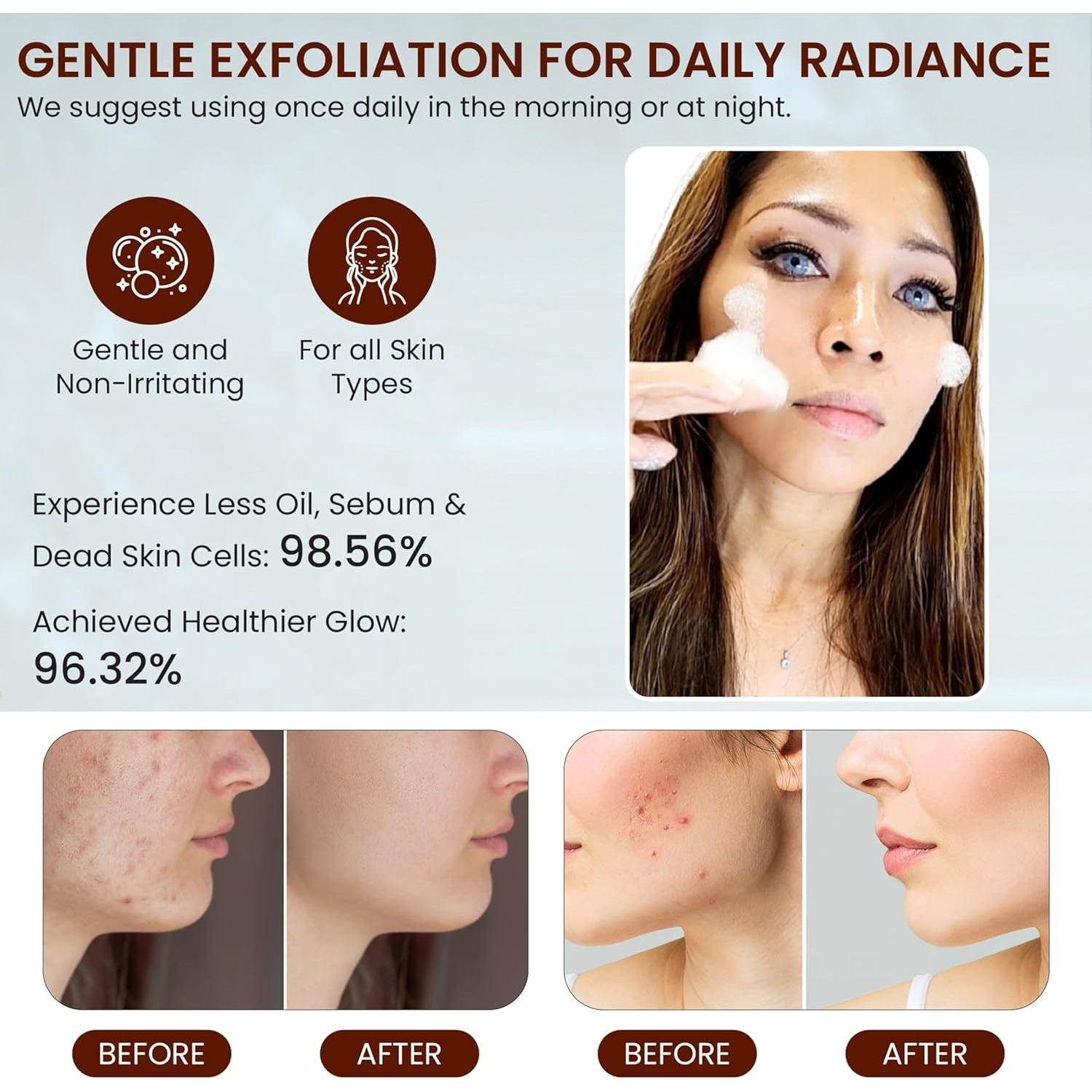 Limpiador Facial Espumoso Live Healthy con Cúrcuma 150ml