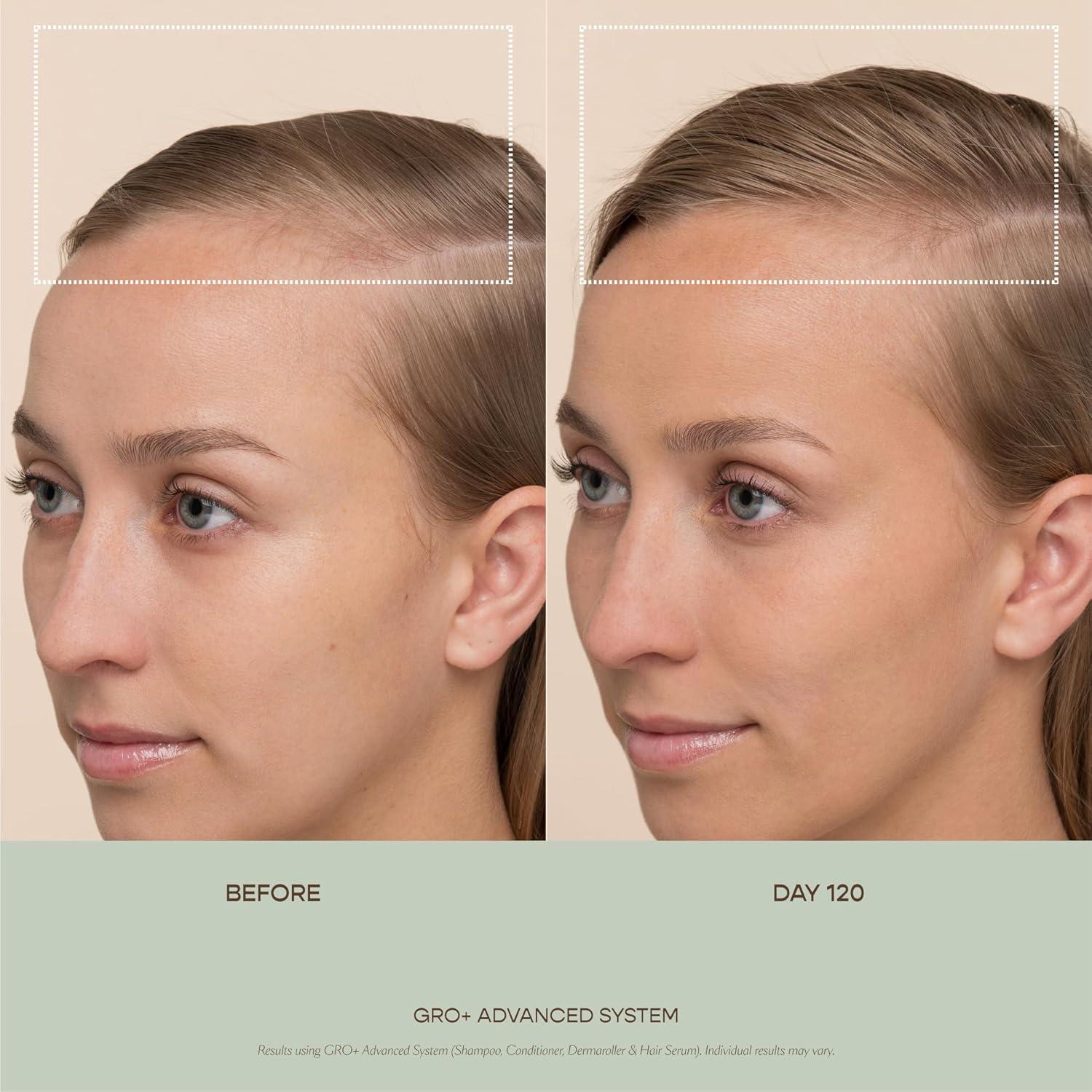 Serum Capilar Vegamour GRO+ 189.9g - Aumenta Densidad y Reduce Caída