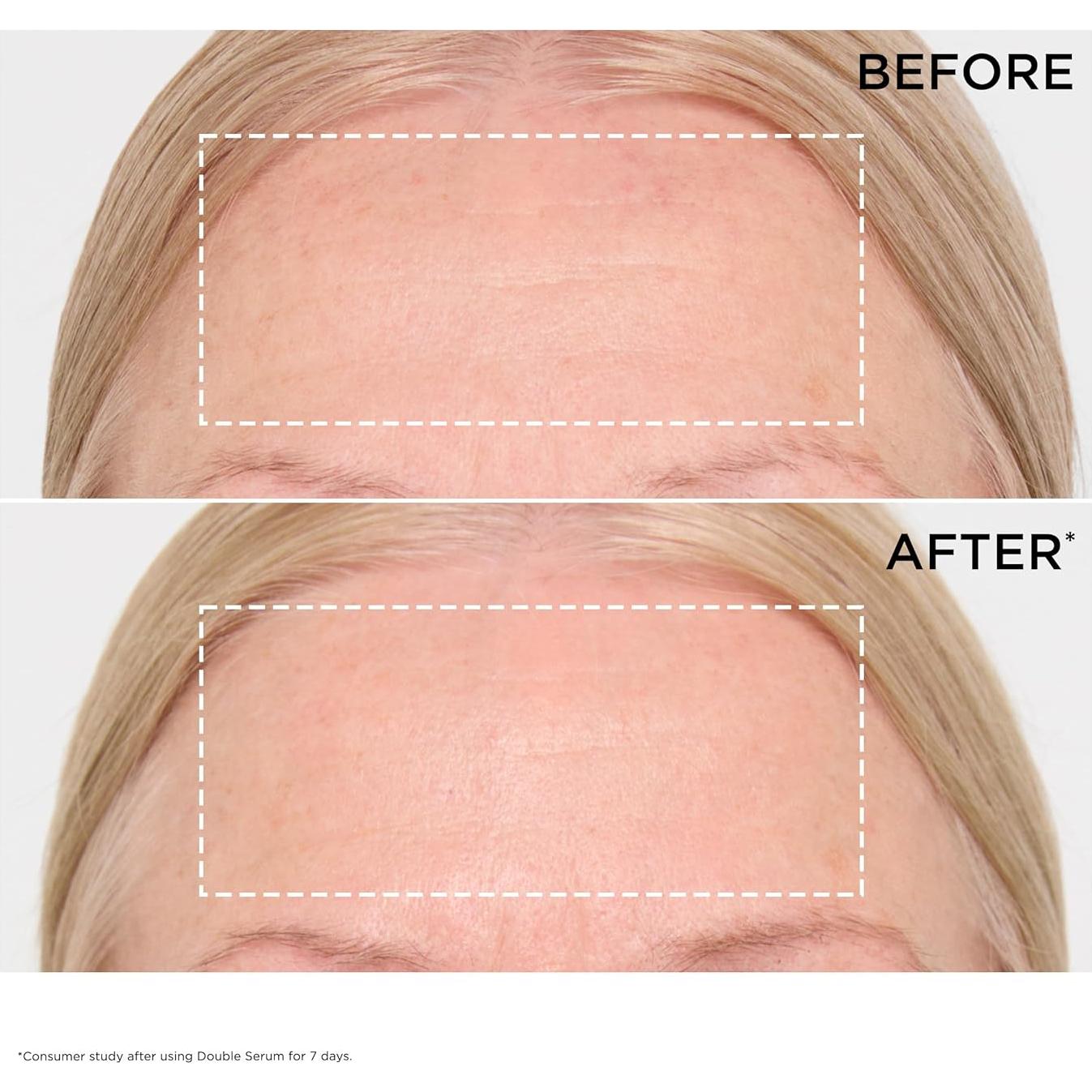 Suero Facial Antienvejecimiento Clarins Doble Suero 50 ml