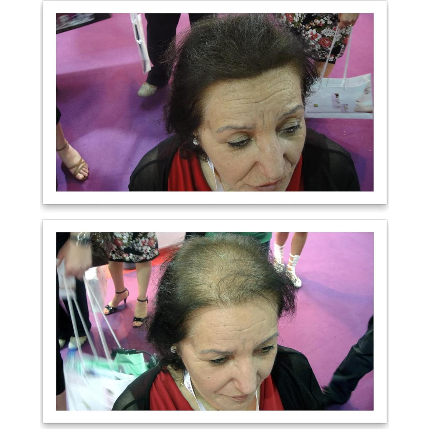 Fibra de Cabello Natural Caboki 3x30g Marrón Oscuro - 270 Días