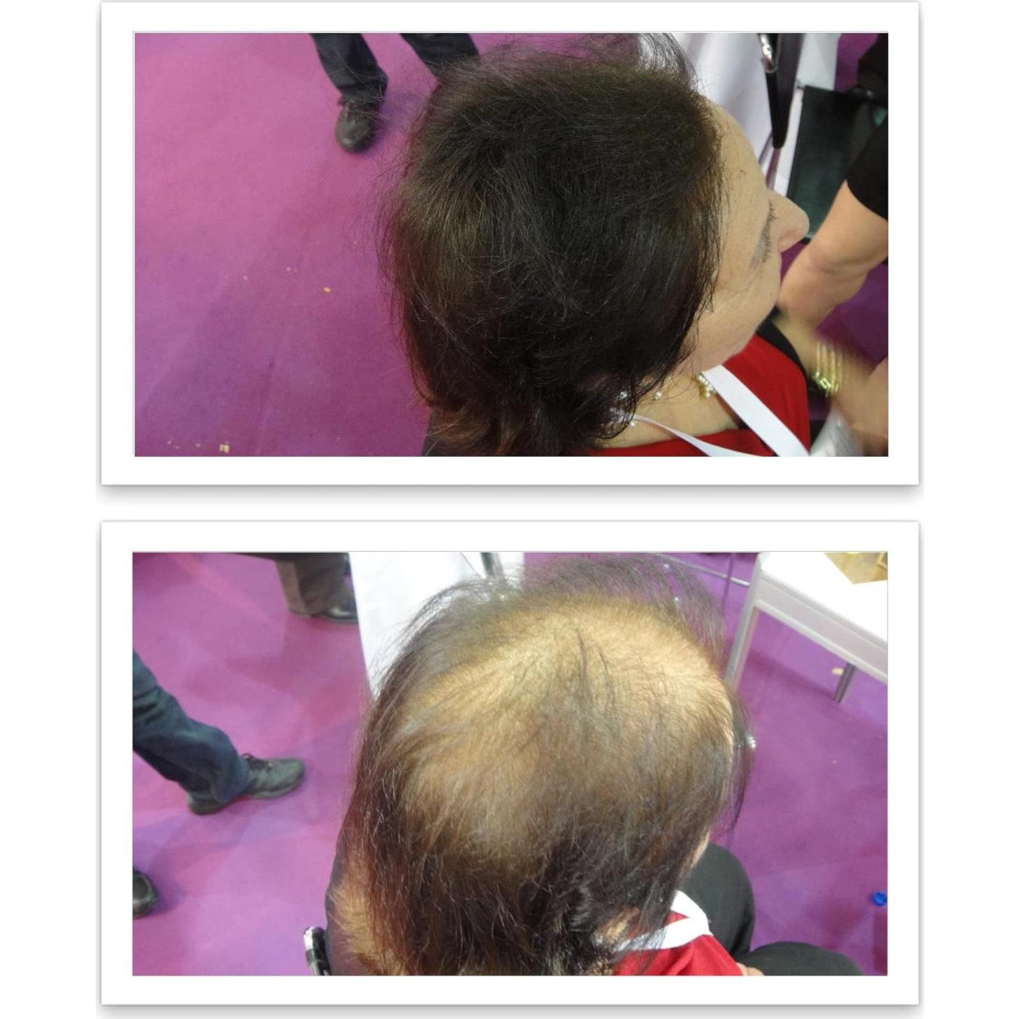 Fibra de Cabello Natural Caboki 3x30g Marrón Oscuro - 270 Días